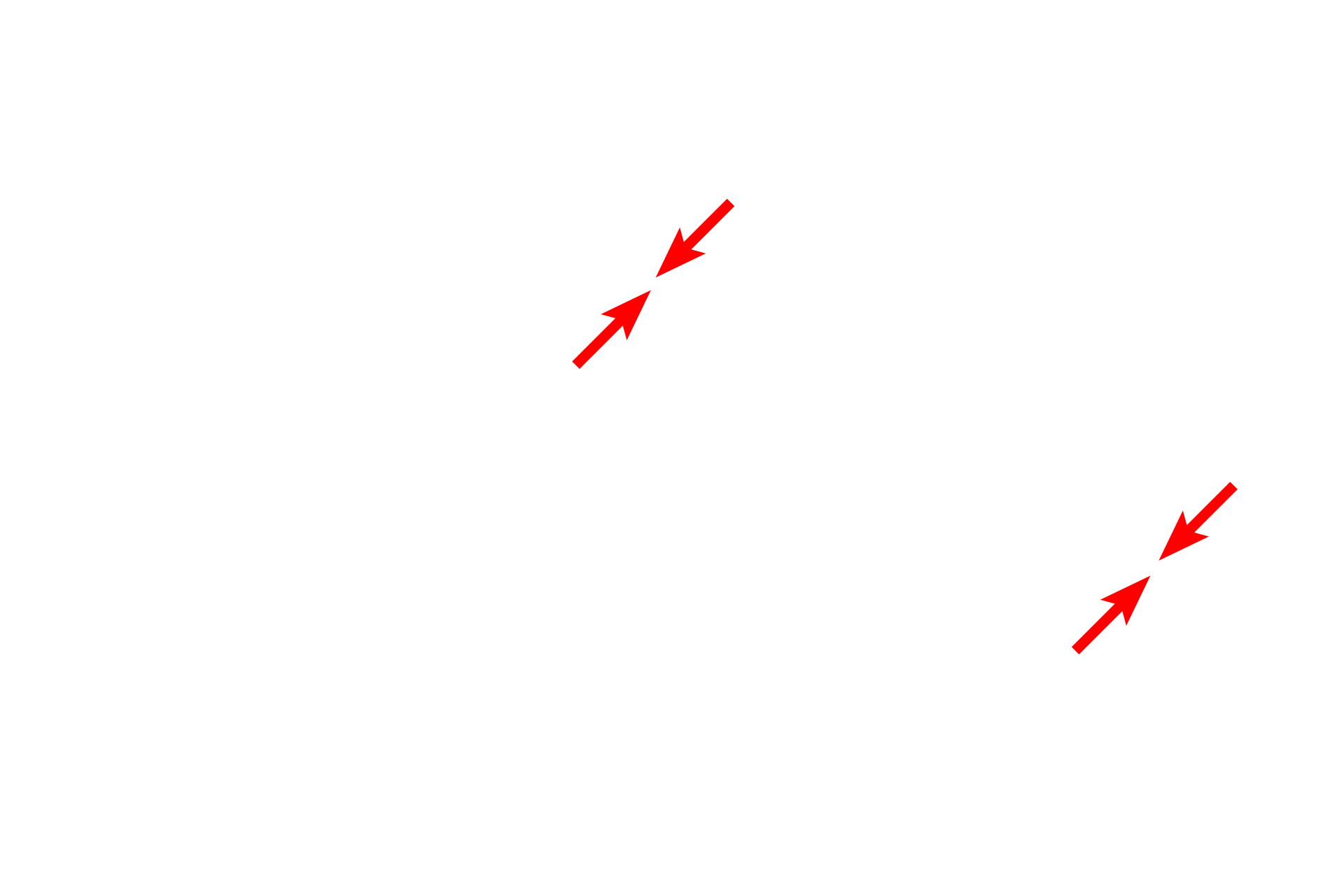 Plasma membranes > <p>The plasma membranes of the cells can be seen running diagonally through the micrograph.</p>
