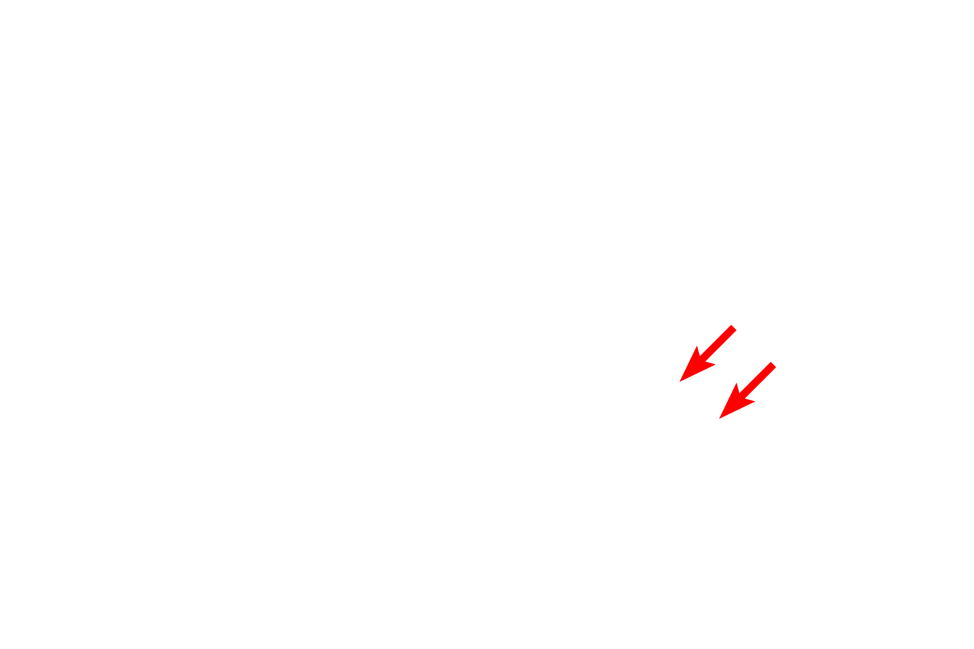  - Cis face <p>The Golgi consists of stacks of smooth, flattened membranous sacs (cisternae), usually located near the nucleus.  Newly synthesized proteins are transferred from the RER by transport vesicles, which fuse with the forming, or cis, face of the Golgi.  From there, proteins move through the mid-Golgi where they are modified, and eventually exit in vesicles from the maturing, or trans, face.  The collection of these vesicles forms the trans-Golgi network along with microtubules for transport throughout the cell.  25,000x</p>
