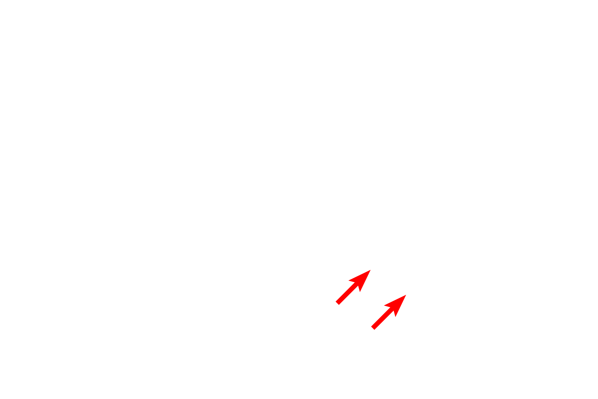  - Trans face <p>The Golgi consists of stacks of smooth, flattened membranous sacs (cisternae), usually located near the nucleus.  Newly synthesized proteins are transferred from the RER by transport vesicles, which fuse with the forming, or cis, face of the Golgi.  From there, proteins move through the mid-Golgi where they are modified, and eventually exit in vesicles from the maturing, or trans, face.  The collection of these vesicles forms the trans-Golgi network along with microtubules for transport throughout the cell.  25,000x</p>
