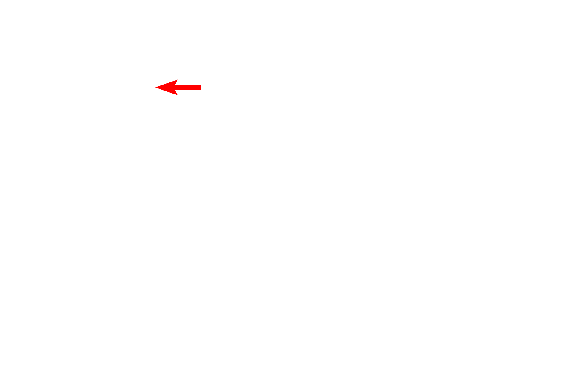 Mitochondrion <p>The Golgi consists of stacks of smooth, flattened membranous sacs (cisternae), usually located near the nucleus.  Newly synthesized proteins are transferred from the RER by transport vesicles, which fuse with the forming, or cis, face of the Golgi.  From there, proteins move through the mid-Golgi where they are modified, and eventually exit in vesicles from the maturing, or trans, face.  The collection of these vesicles forms the trans-Golgi network along with microtubules for transport throughout the cell.  25,000x</p>
