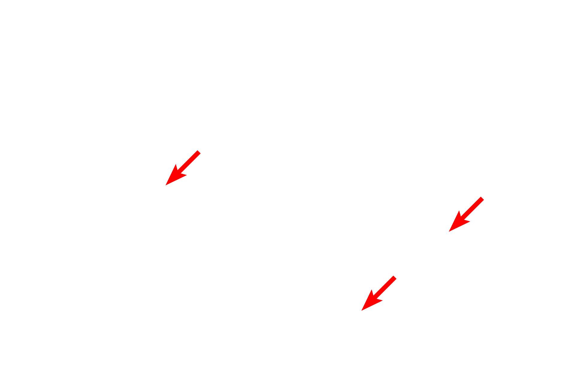 Golgi complexes <p>The Golgi apparatus is most often located adjacent to the nucleus; however, in cells such as the one shown here, there can be multiple Golgi complexes, some of which are located at a distance from the nucleus.  20,000x</p>

