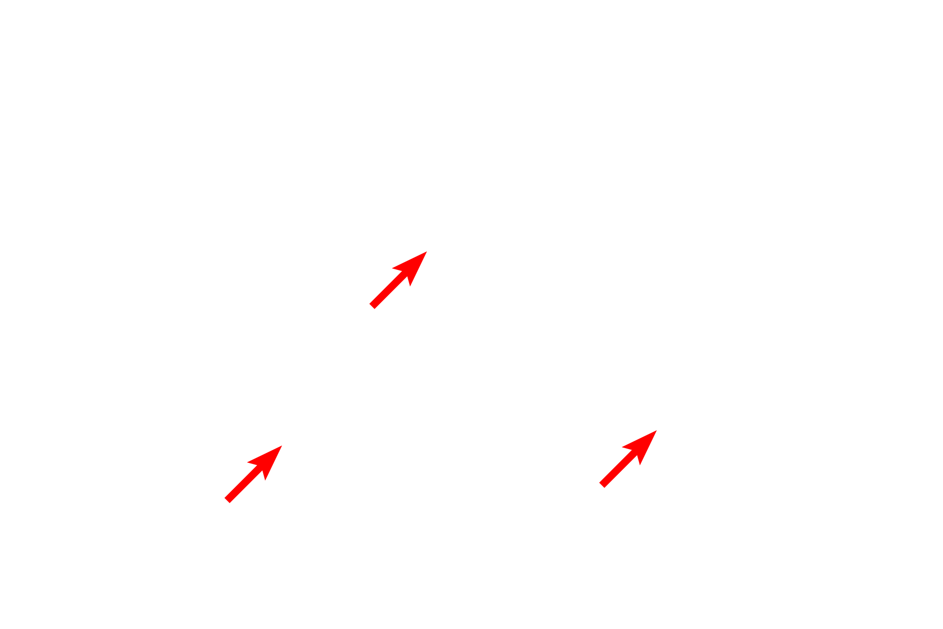 Mitochondria <p>The Golgi apparatus is most often located adjacent to the nucleus; however, in cells such as the one shown here, there can be multiple Golgi complexes, some of which are located at a distance from the nucleus.  20,000x</p>
