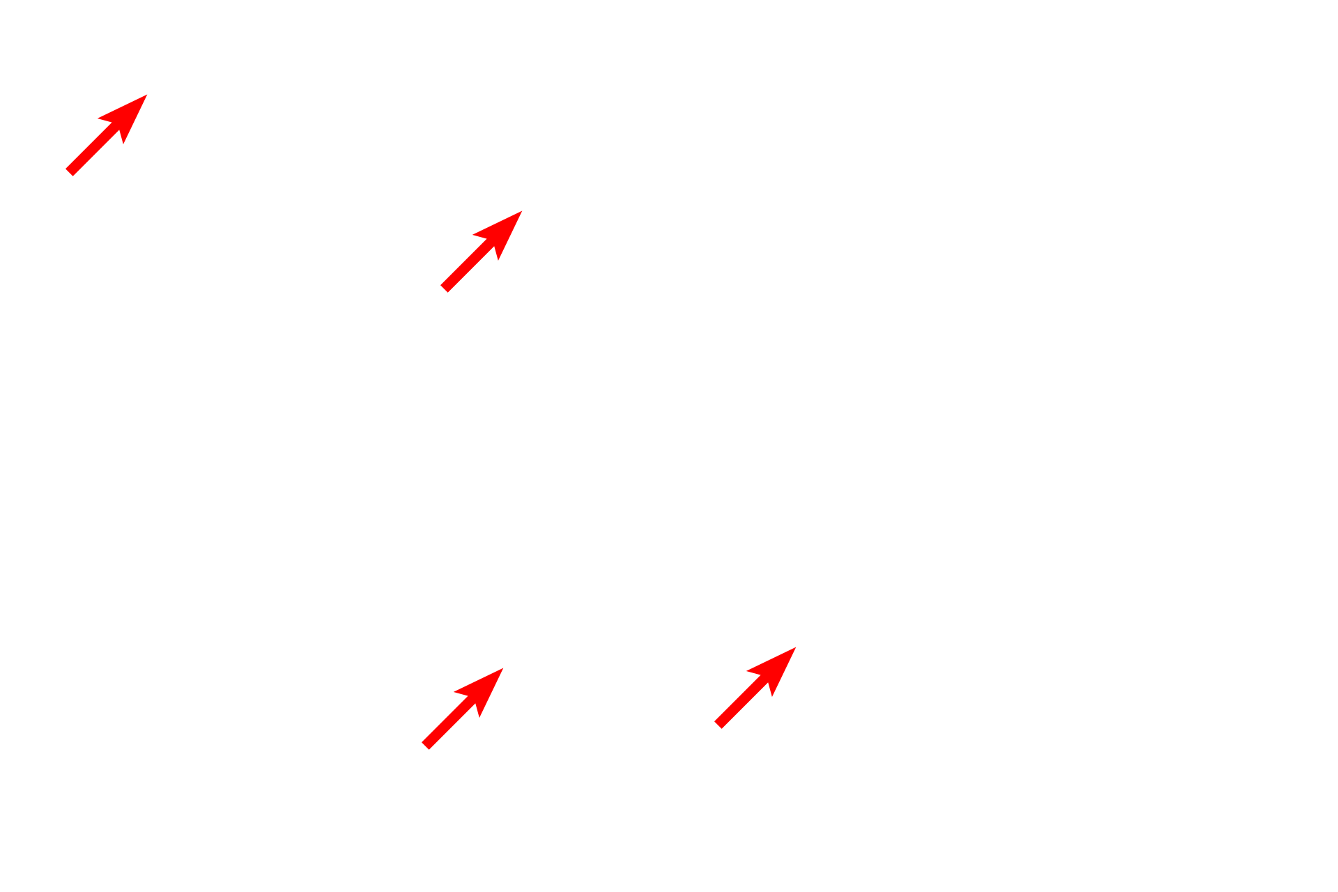 RER <p>The Golgi apparatus is most often located adjacent to the nucleus; however, in cells such as the one shown here, there can be multiple Golgi complexes, some of which are located at a distance from the nucleus.  20,000x</p>
