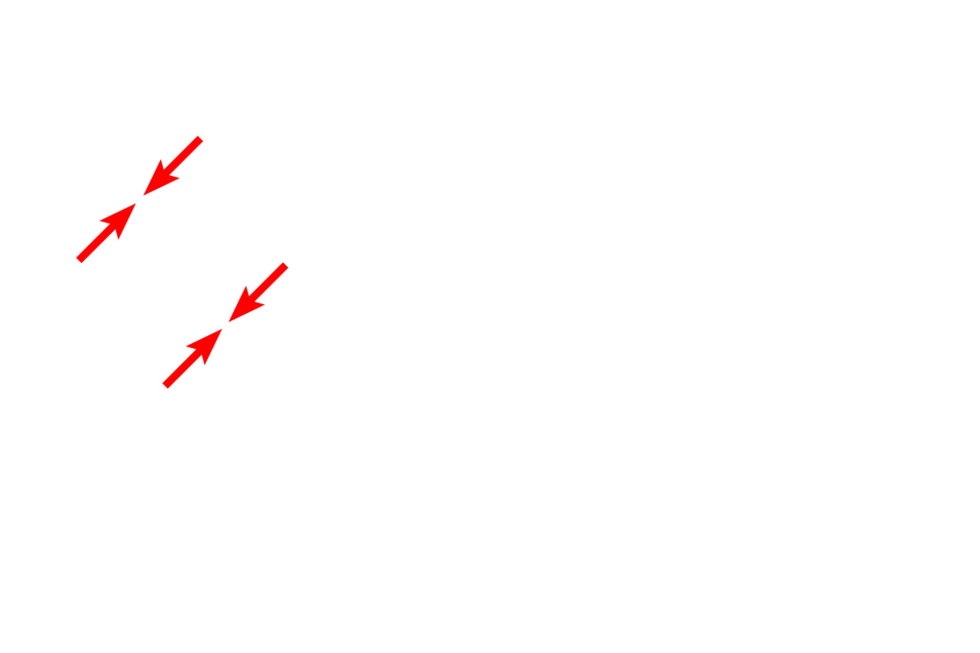  - Nuclear envelope <p>The Golgi apparatus is most often located adjacent to the nucleus; however, in cells such as the one shown here, there can be multiple Golgi complexes, some of which are located at a distance from the nucleus.  20,000x</p>
