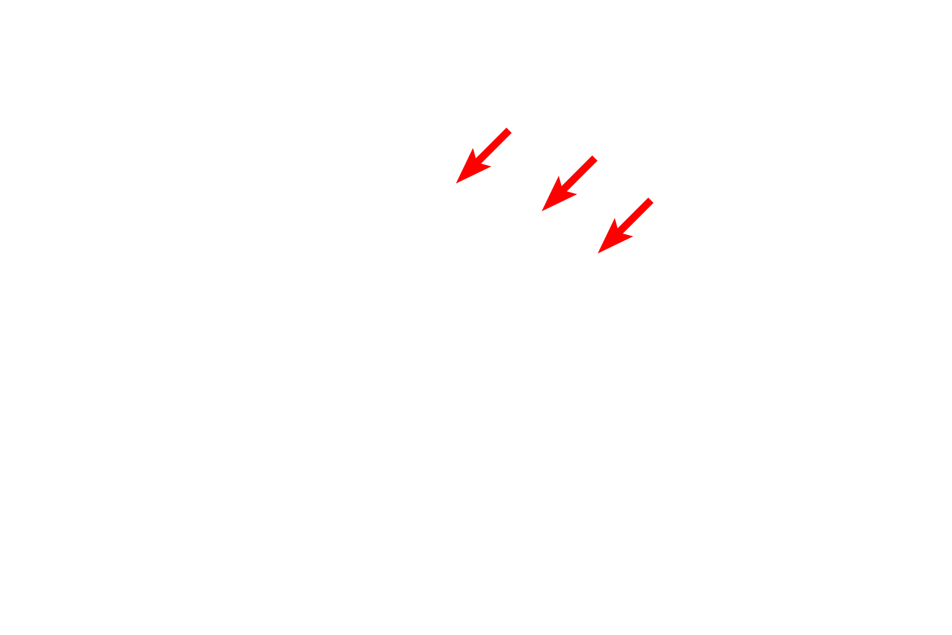  - Cis face <p>The Golgi consists of stacks of smooth, membranous sacs, usually located near the nucleus.  Newly synthesized proteins are transferred from the RER by transport vesicles, which fuse with the forming, or cis, face of the Golgi.  Proteins move through the Golgi, are modified, and eventually exit in vesicles derived from the maturing, or trans, face.  40,000x</p>

