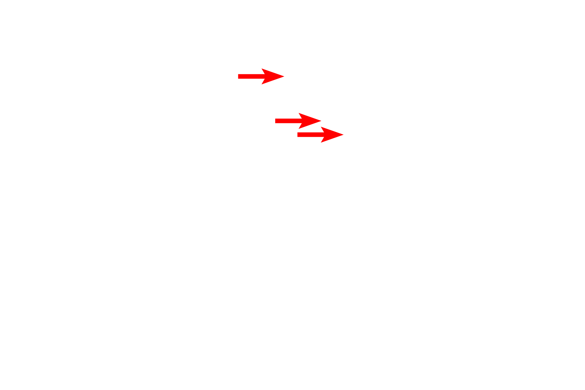  - Transport vesicles <p>The Golgi consists of stacks of smooth, membranous sacs, usually located near the nucleus.  Newly synthesized proteins are transferred from the RER by transport vesicles, which fuse with the forming, or cis, face of the Golgi.  Proteins move through the Golgi, are modified, and eventually exit in vesicles derived from the maturing, or trans, face.  40,000x</p>
