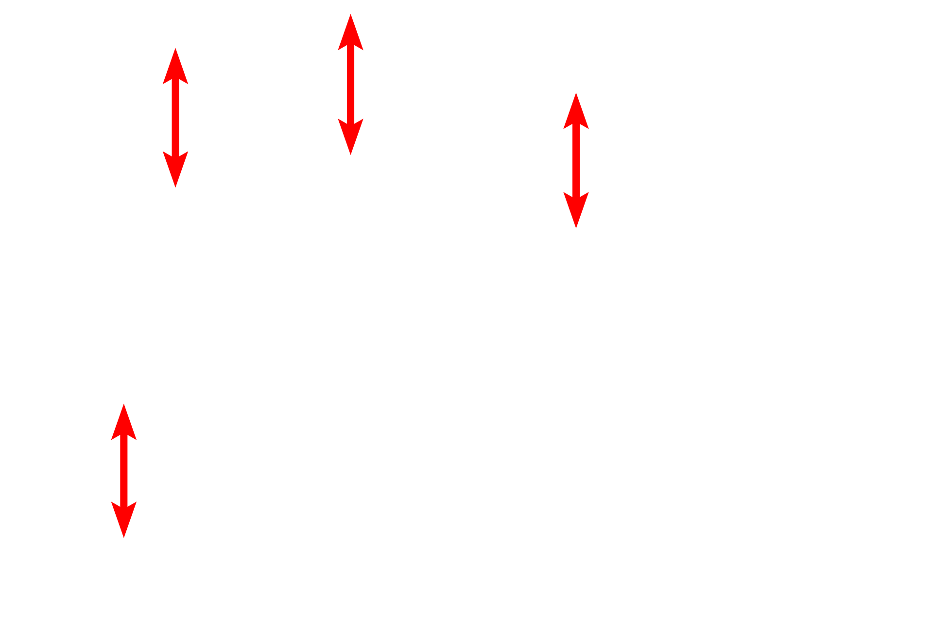Adipocytes filled with lipid <p>A small accumulation of adipocytes is visible in this loose connective tissue.  This tissue has been fixed with osmium tetroxide, which preserves the large lipid droplet in the cytoplasm of the adipocyte and provides the brown-black staining of the lipid.  The lipid in these vesicles consists of triglycerides and is not surrounded by a membrane.  Toluidine blue stain.  1000x</p>
