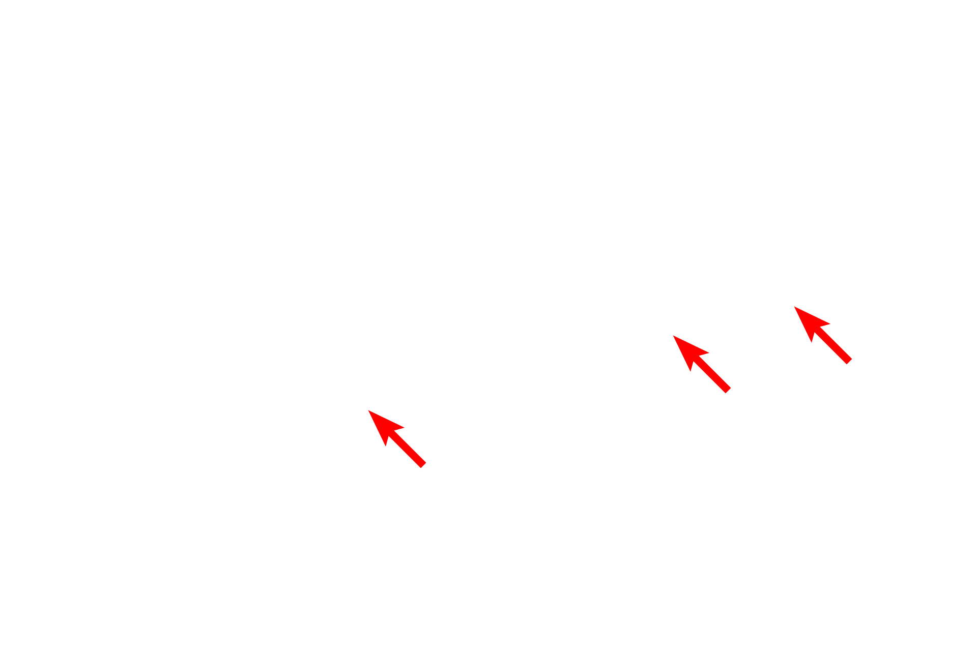 Collagen fibers <p>A small accumulation of adipocytes is visible in this loose connective tissue.  This tissue has been fixed with osmium tetroxide, which preserves the large lipid droplet in the cytoplasm of the adipocyte and provides the brown-black staining of the lipid.  The lipid in these vesicles consists of triglycerides and is not surrounded by a membrane.  Toluidine blue stain.  1000x</p>
