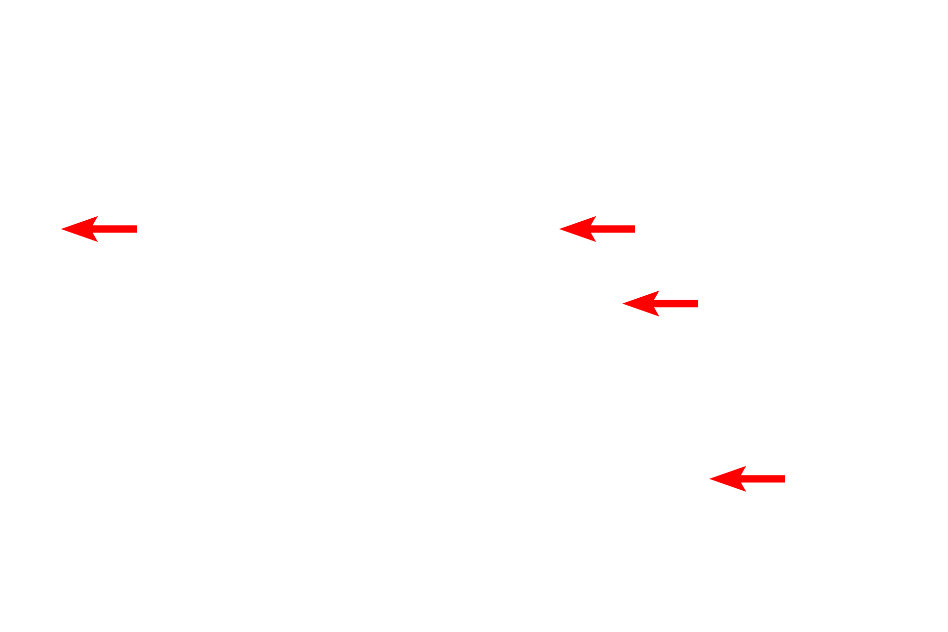 Lipid droplets <p>Unlike the single, large lipid droplet seen in adipocytes, lipid can also be present as numerous small droplets in the cytoplasm.  This oviductal epithelium has been fixed with osmium tetroxide, which stabilizes the lipid, preventing it from being extracted by fat solvents used during tissue processing.  Osmium stains a yellowish-brown color.  Toluidine blue stain  1000x</p>
