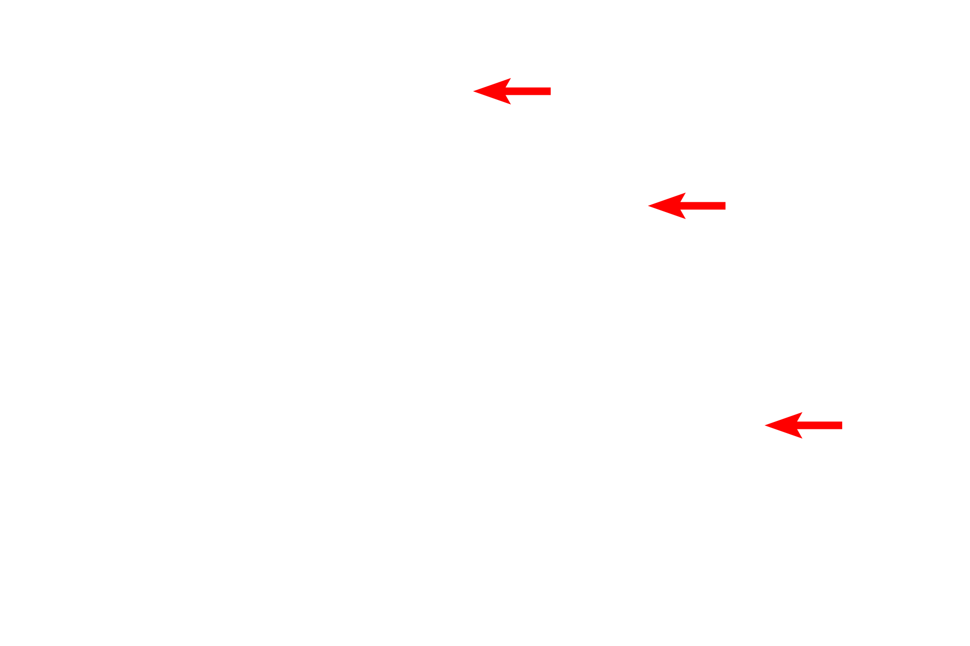 Cilia <p>Unlike the single, large lipid droplet seen in adipocytes, lipid can also be present as numerous small droplets in the cytoplasm.  This oviductal epithelium has been fixed with osmium tetroxide, which stabilizes the lipid, preventing it from being extracted by fat solvents used during tissue processing.  Osmium stains a yellowish-brown color.  Toluidine blue stain  1000x</p>
