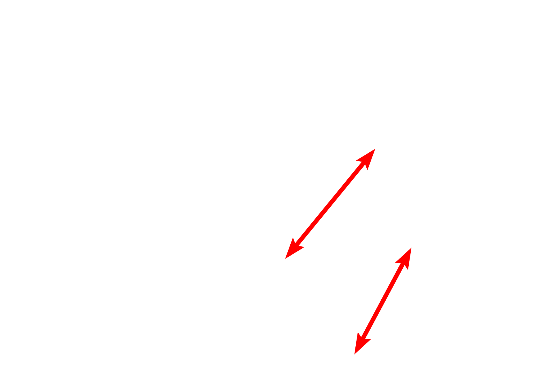 Columnar cells <p>Unlike the single, large lipid droplet seen in adipocytes, lipid can also be present as numerous small droplets in the cytoplasm.  This oviductal epithelium has been fixed with osmium tetroxide, which stabilizes the lipid, preventing it from being extracted by fat solvents used during tissue processing.  Osmium stains a yellowish-brown color.  Toluidine blue stain  1000x</p>
