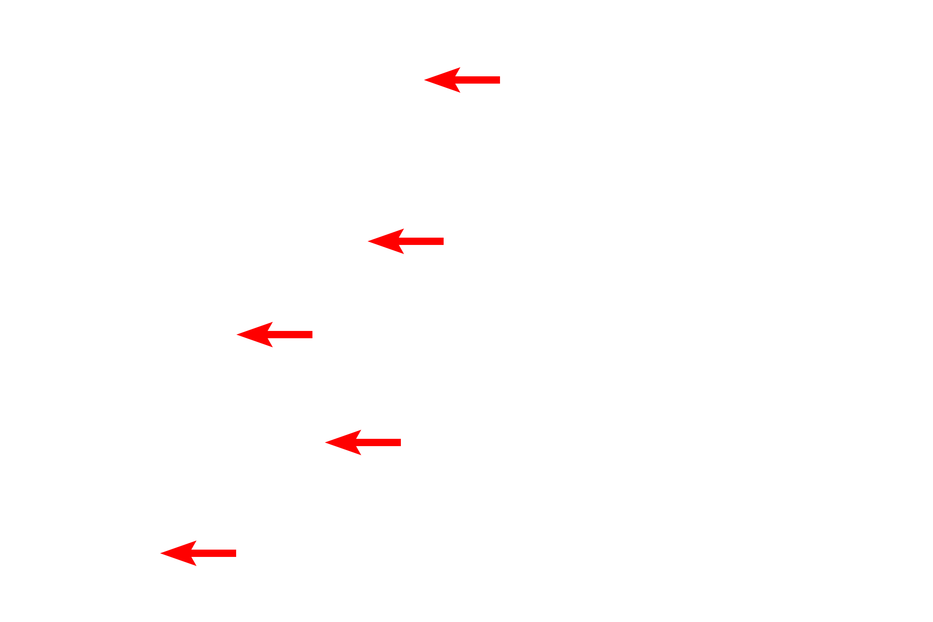 Lipid droplets <p>At the electron microscopic level, the presence of the osmium, which is a heavy metal, gives the lipid a grainy appearance with moderate electron density.  Lipid droplets vary in size and often coalesce into larger droplets.  Lipid droplets are not surrounded by a membrane.  Liver  15,000x</p>
