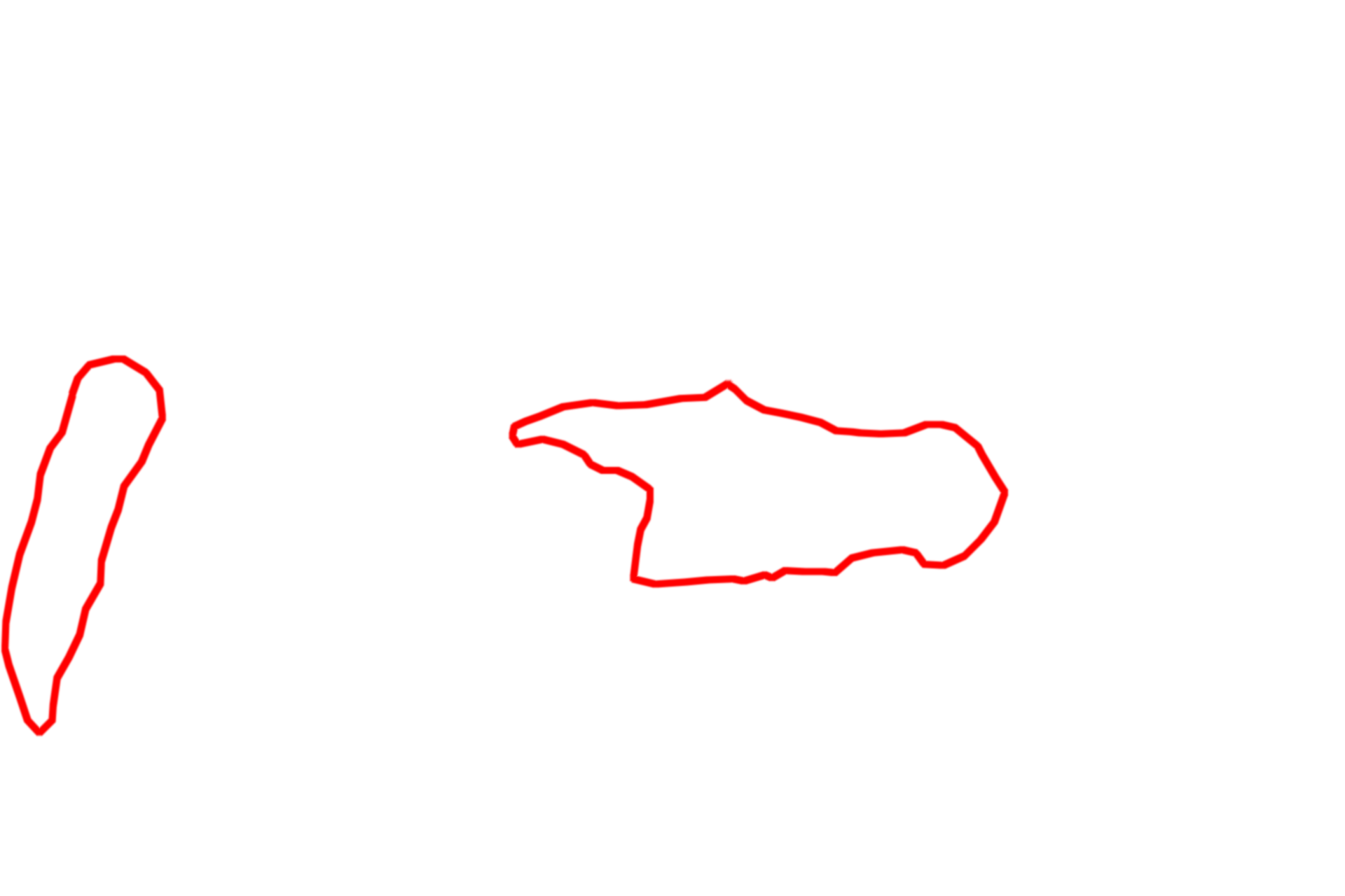 RER <p>At the electron microscopic level, the presence of the osmium, which is a heavy metal, gives the lipid a grainy appearance with moderate electron density.  Lipid droplets vary in size and often coalesce into larger droplets.  Lipid droplets are not surrounded by a membrane.  Liver  15,000x</p>
