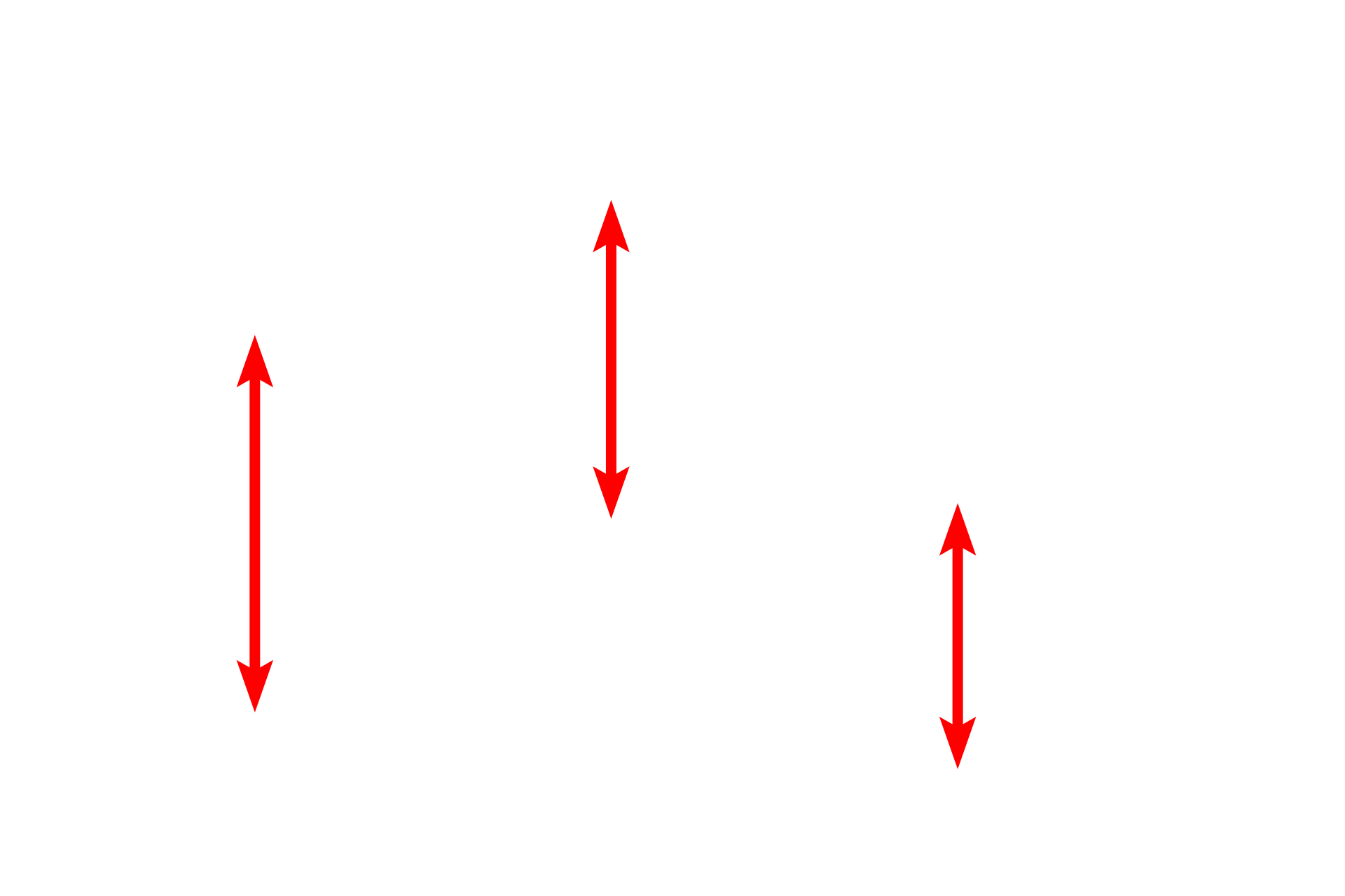 Lipid droplets <p>This electron micrograph shows two elongated cells with numerous lipid droplets in their cytoplasm.  The lipid droplets appear homogenous and are not surrounded by a membrane.  This tissue was fixed with osmium tetroxide, which preserves the lipid and prevents it being dissolved during tissue processing.  6000x</p>
