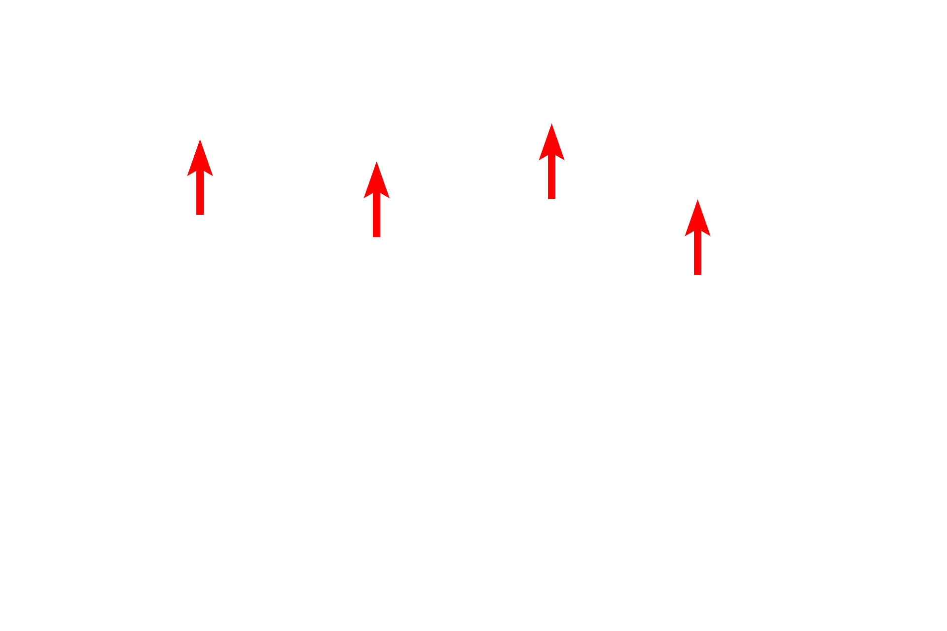 Lysosomes <p>Lysosomes are single-membrane organelles and their contents appear amorphous and highly variable, reflecting their contents and their stages of degradation.  The hydrolytic enzymes in the lysosome are activated by acidification of the contents by proton pumps located in the lysosomal membrane.  The decreased internal pH is optimal for the activity of the acid hydrolases.  This acidification occurs after fusion of the pre-lysosomal vesicle with the material to be degraded.  30,000x</p>
