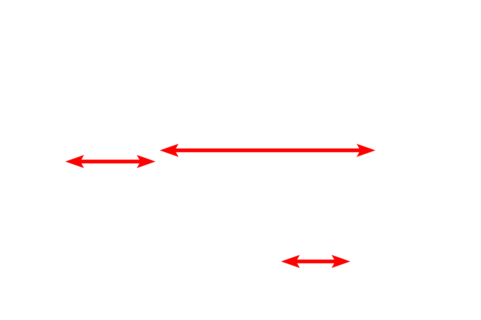 Mitochondria <p>Lysosomes are single-membrane organelles and their contents appear amorphous and highly variable, reflecting their contents and their stages of degradation.  The hydrolytic enzymes in the lysosome are activated by acidification of the contents by proton pumps located in the lysosomal membrane.  The decreased internal pH is optimal for the activity of the acid hydrolases.  This acidification occurs after fusion of the pre-lysosomal vesicle with the material to be degraded.  30,000x</p>
