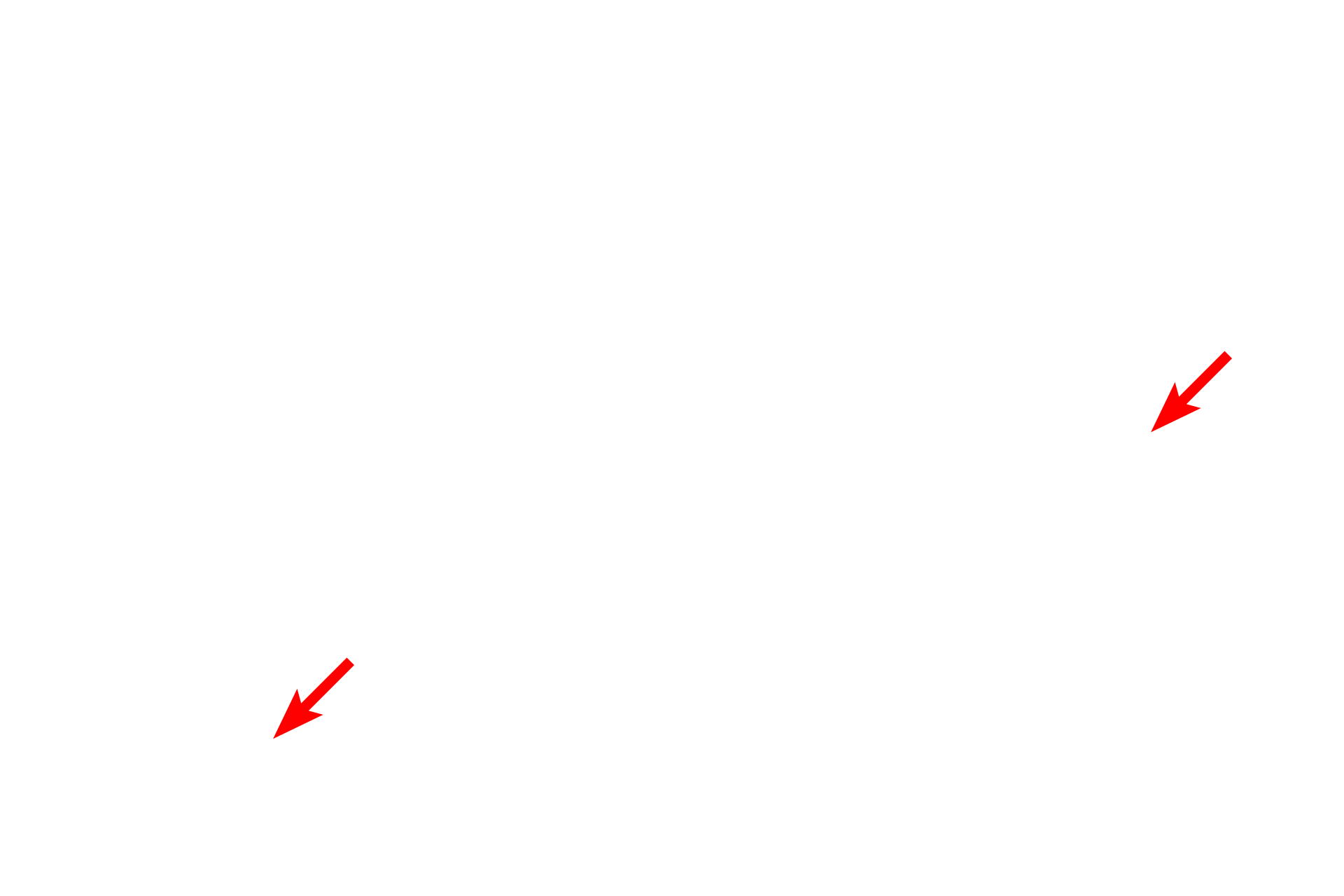 RER <p>Lysosomes are single-membrane organelles and their contents appear amorphous and highly variable, reflecting their contents and their stages of degradation.  The hydrolytic enzymes in the lysosome are activated by acidification of the contents by proton pumps located in the lysosomal membrane.  The decreased internal pH is optimal for the activity of the acid hydrolases.  This acidification occurs after fusion of the pre-lysosomal vesicle with the material to be degraded.  30,000x</p>
