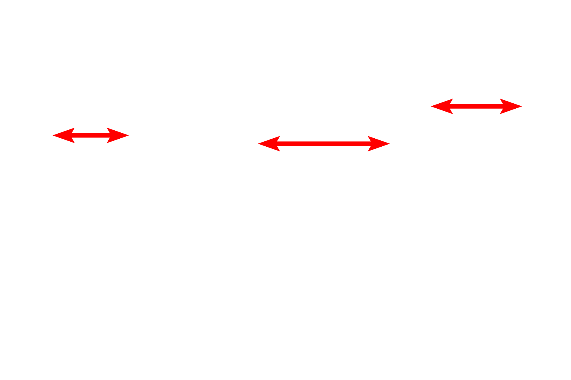 Mitochondria <p>Lysosomes are organelles which contain hydrolytic enzymes and are surrounded by a single unit membrane.  The contents of a lysosome can appear highly heterogeneous depending on the type of material that is being broken down.  Lysosomes form by the fusion of Golgi-derived, pre-lysosomal vesicles with either internalized materials or autophagosomes.  30,000x</p>
