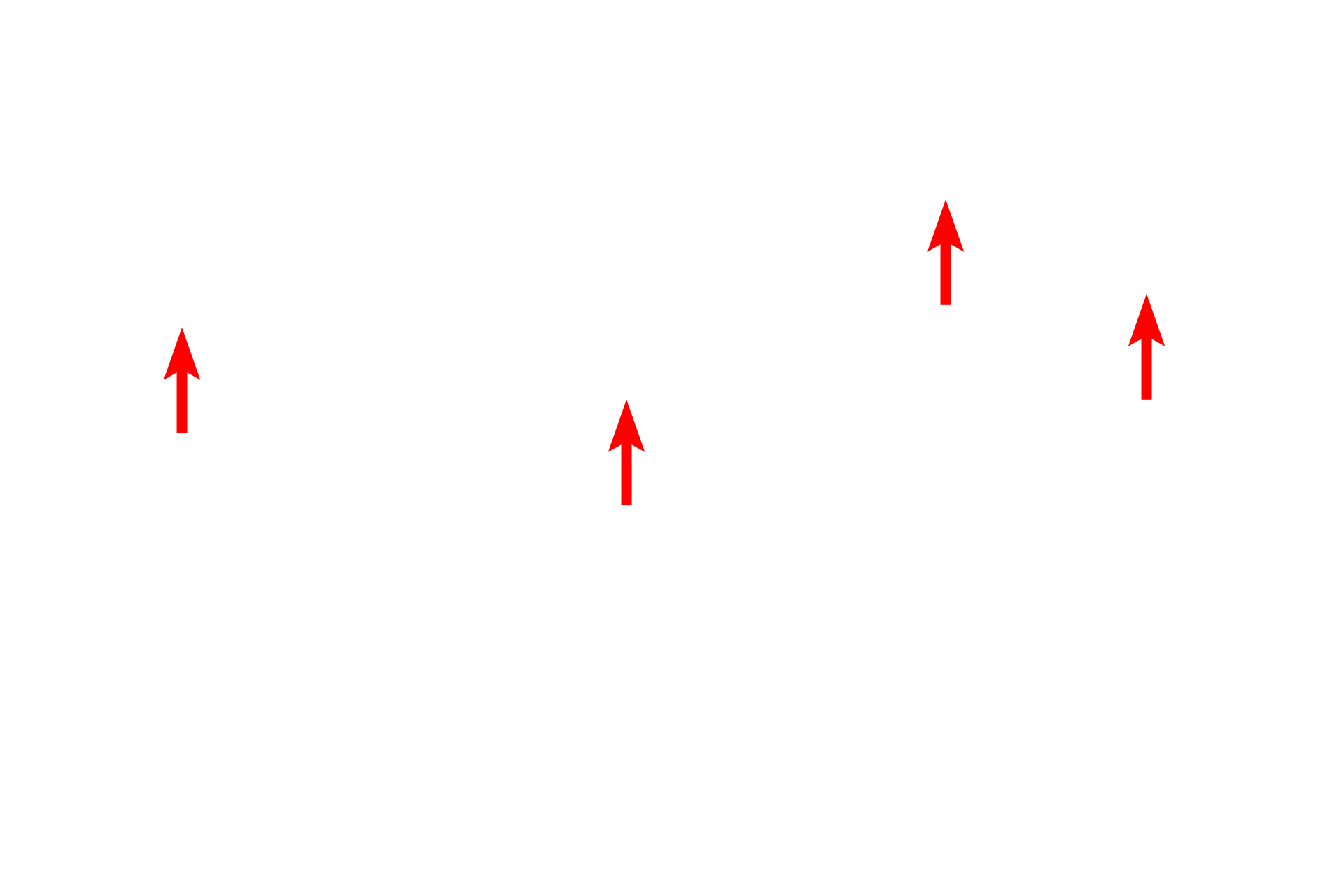  - Cristae <p>Lysosomes are organelles which contain hydrolytic enzymes and are surrounded by a single unit membrane.  The contents of a lysosome can appear highly heterogeneous depending on the type of material that is being broken down.  Lysosomes form by the fusion of Golgi-derived, pre-lysosomal vesicles with either internalized materials or autophagosomes.  30,000x</p>
