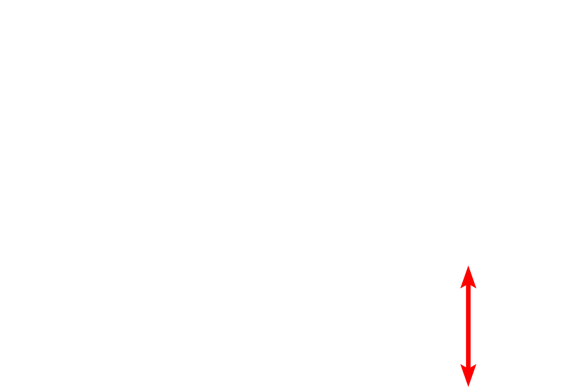 Lysosome <p>This electron micrograph shows the irregular outline of a lysosome in the lower right corner of the image.  The heterogeneous contents of the lysosome are breakdown products of recycled organelles and internalized materials.  Note also the RER, ribosomes and mitochondria in this image.  30,000x</p>
