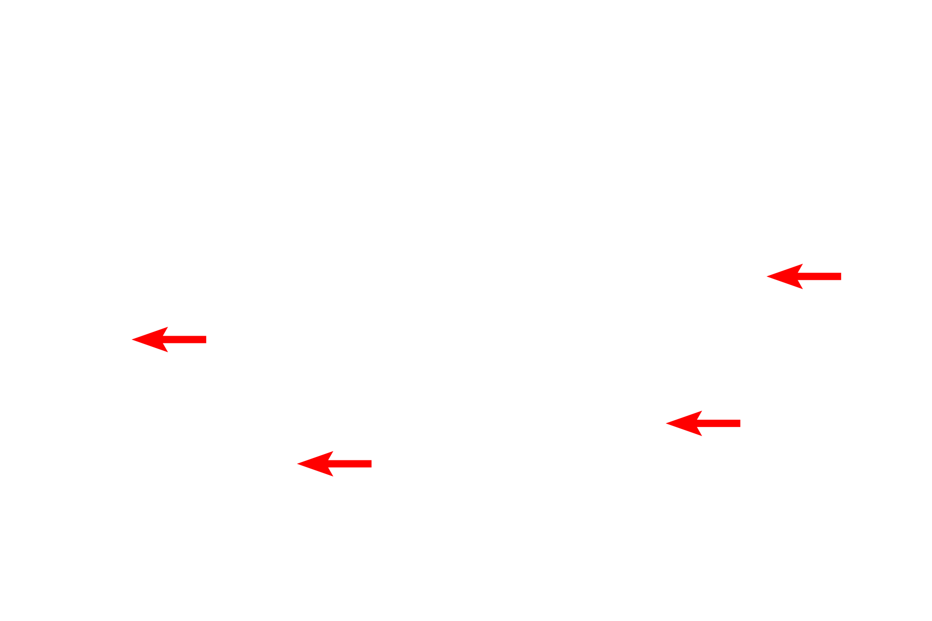 Polysomes <p>This electron micrograph shows the irregular outline of a lysosome in the lower right corner of the image.  The heterogeneous contents of the lysosome are breakdown products of recycled organelles and internalized materials.  Note also the RER, ribosomes and mitochondria in this image.  30,000x</p>

