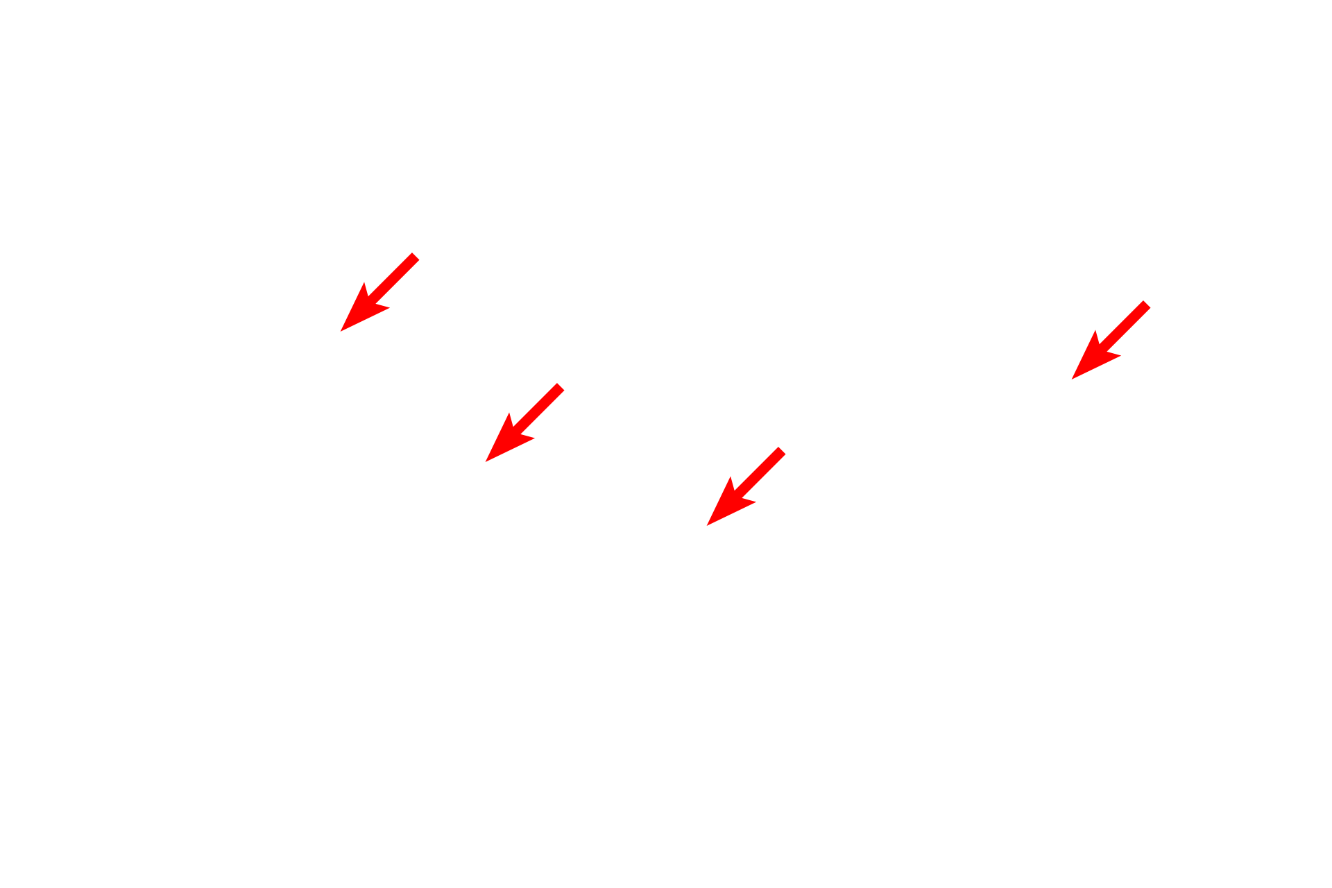 Lipid leaflet <p>Freeze fracture is a technique used to visualize integral membrane proteins.  Cells are frozen and then fractured, which separates the two phospholipid layers of the membrane and allows the examination of the inner surface of each leaflet.  Shown here are membranes of unmyelinated axons.  Proteins appear as bumps; the remainder of the surface is lipid.  100,000x</p>
