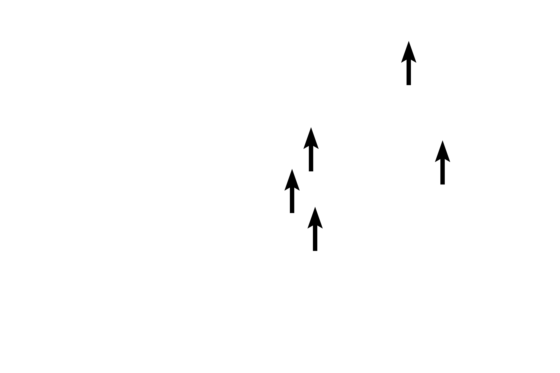 Plasma membranes <p>The plasma membrane is the unique membrane surrounding the cell, but a single membrane cannot be resolved with the light microscope.  Therefore, the line visible between adjacent cells represents the plasma membranes of both cells, as well as intercellular space, cytoskeletal elements, and proteins associated with the membrane.  Kidney  1000x</p>
