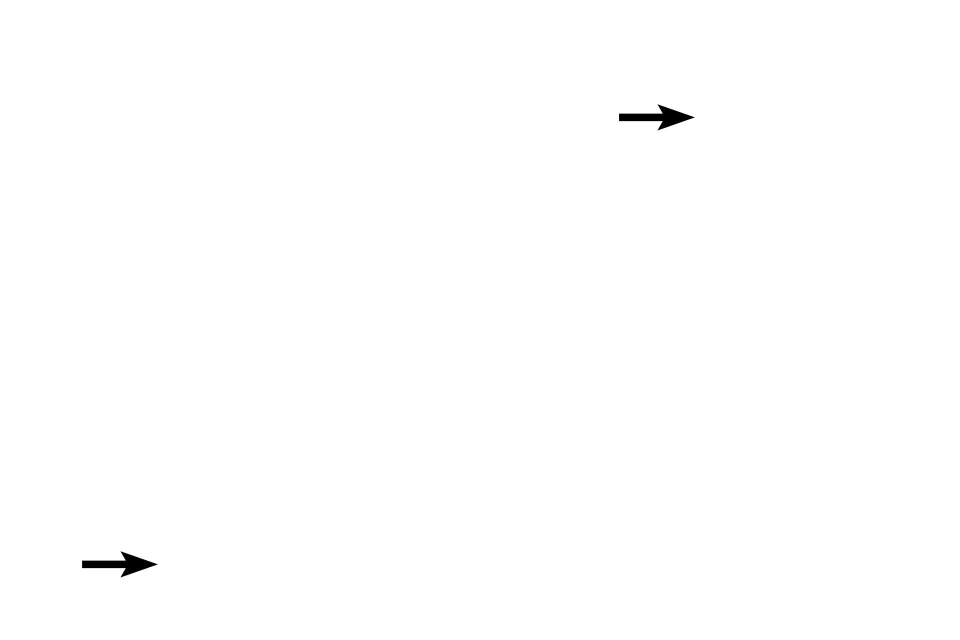 Cuboidal cells <p>The plasma membrane is the unique membrane surrounding the cell, but a single membrane cannot be resolved with the light microscope.  Therefore, the line visible between adjacent cells represents the plasma membranes of both cells, as well as intercellular space, cytoskeletal elements, and proteins associated with the membrane.  Kidney  1000x</p>
