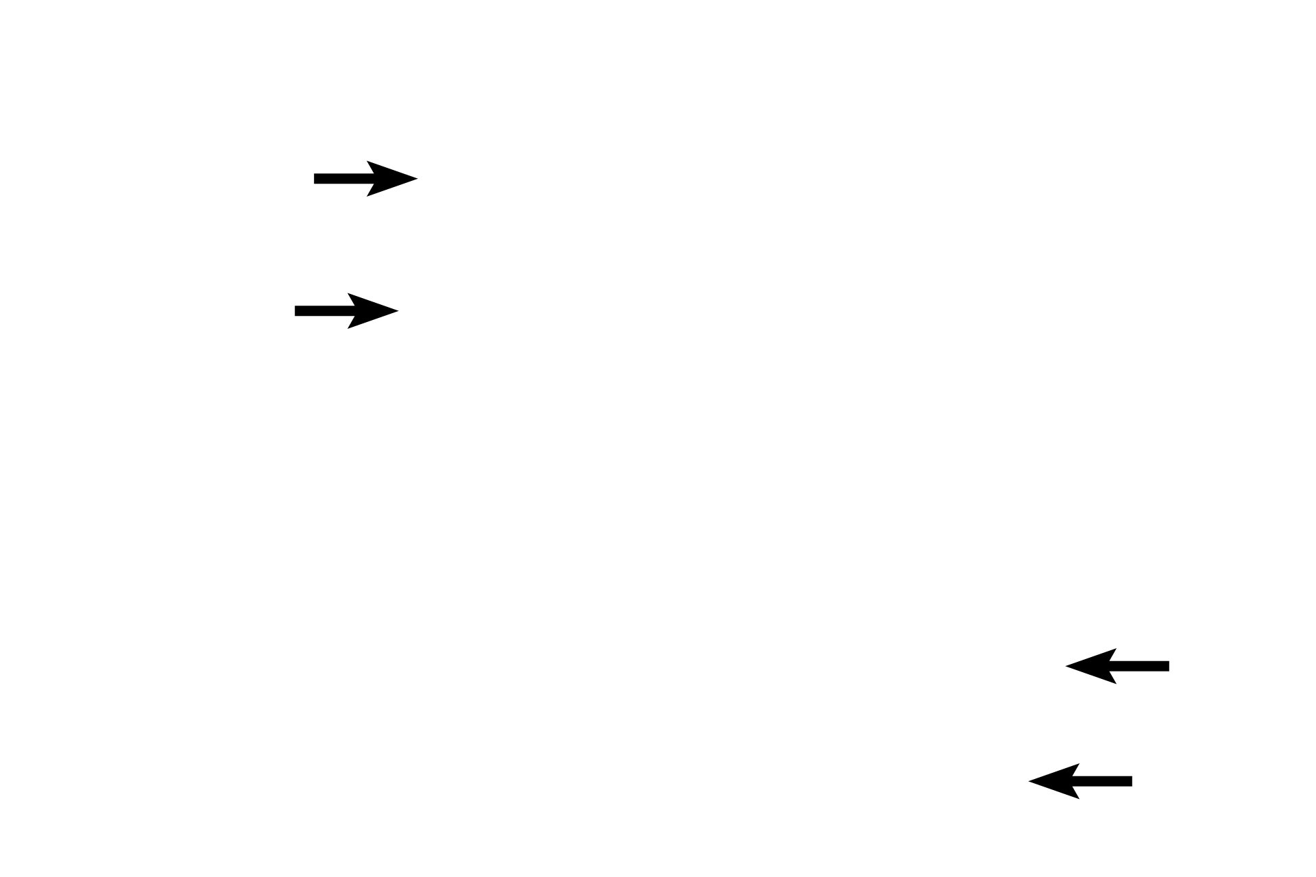 Squamous cells <p>The plasma membrane is the unique membrane surrounding the cell, but a single membrane cannot be resolved with the light microscope.  Therefore, the line visible between adjacent cells represents the plasma membranes of both cells, as well as intercellular space, cytoskeletal elements, and proteins associated with the membrane.  Kidney  1000x</p>
