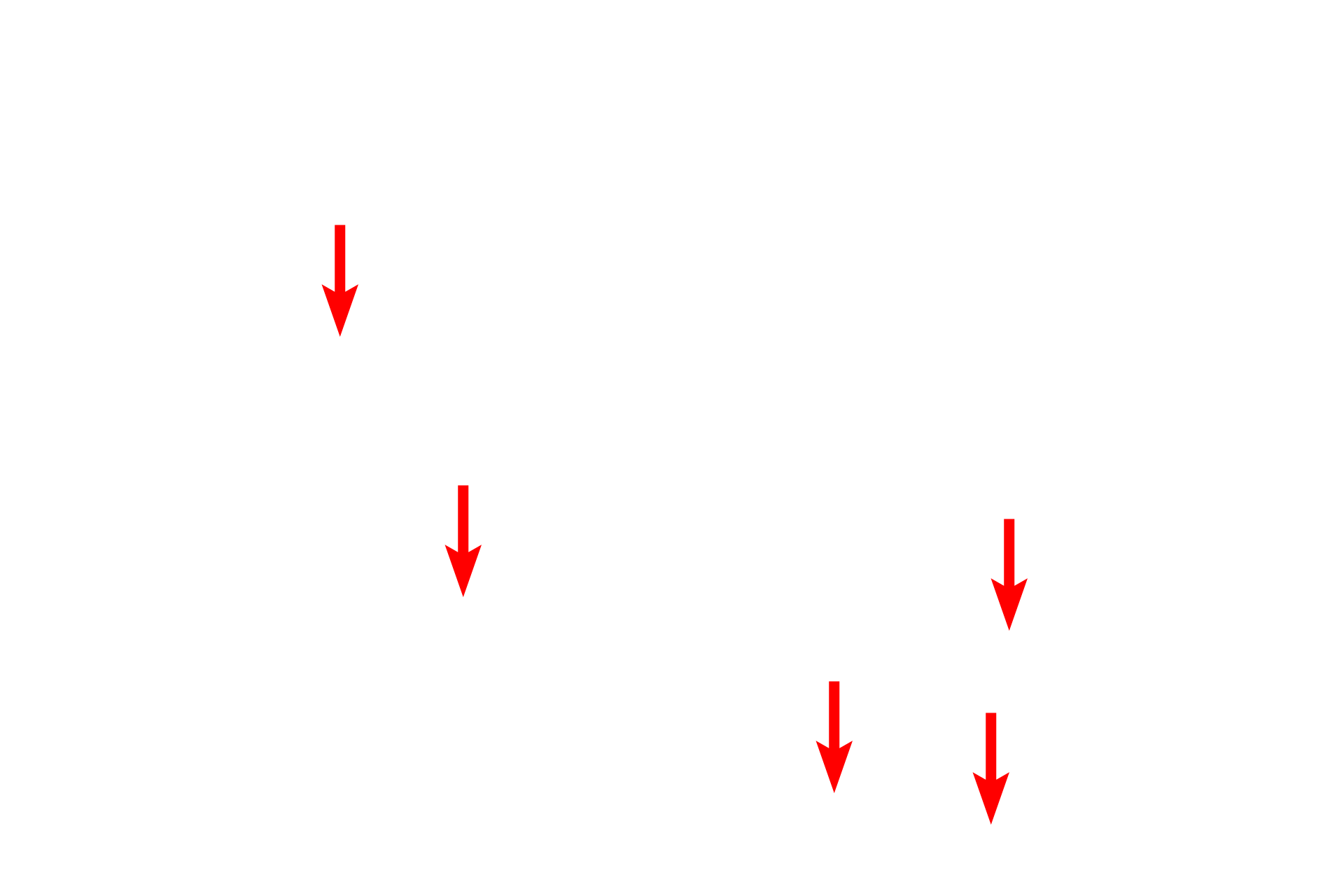 RER > <p>Intracellular membranes, e.g. those forming the endoplasmic reticulum, are also composed of membranes with a similar structure and appearance as the plasma membrane.  Rough endoplasmic reticulum is studded with ribosomes.</p>
