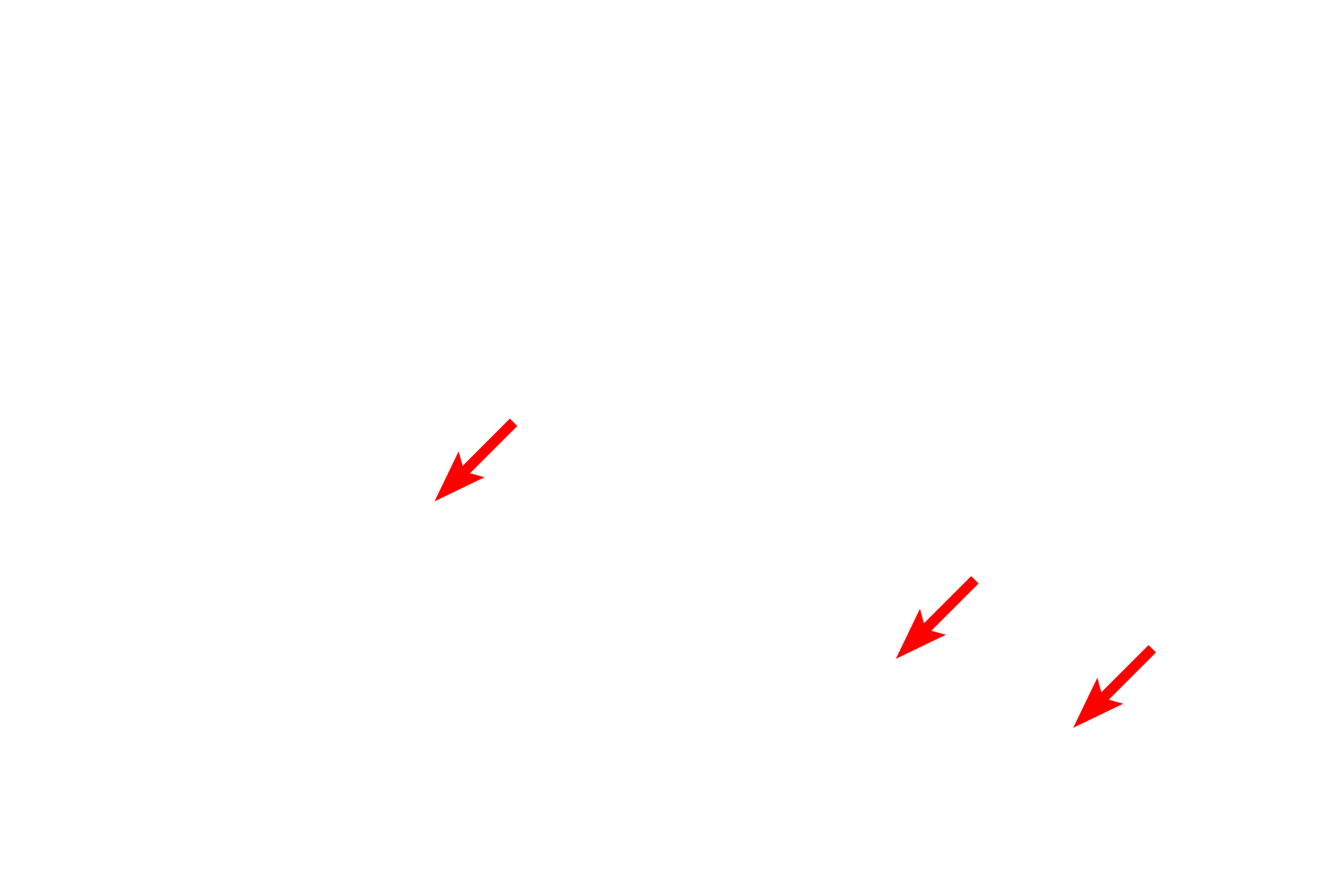 Intercellular space > <p>The intercellular space contains numerous cellular extensions.</p>
