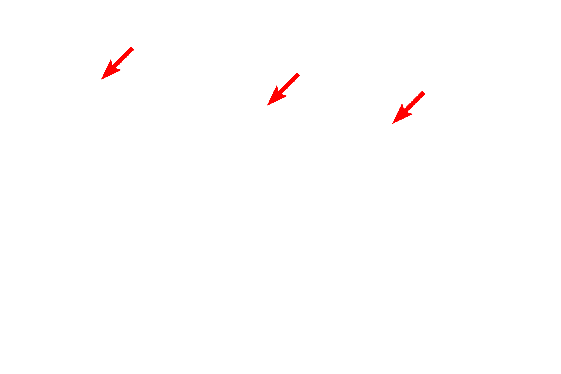 Glycocalyx <p>A unique feature of the plasma membrane is the glycocalyx, a fuzzy, carbohydrate-rich layer only present on the external cell surface. This layer consists of carbohydrate chains attached to proteins and lipids, as well as secreted proteoglycans.  The glycocalyx provides a microdomain for enzymatic digestion, cell recognition and adhesion.  In this image, the glycocalyx is seen projecting from the tips of small cell processes called microvilli.  10,000x</p>
