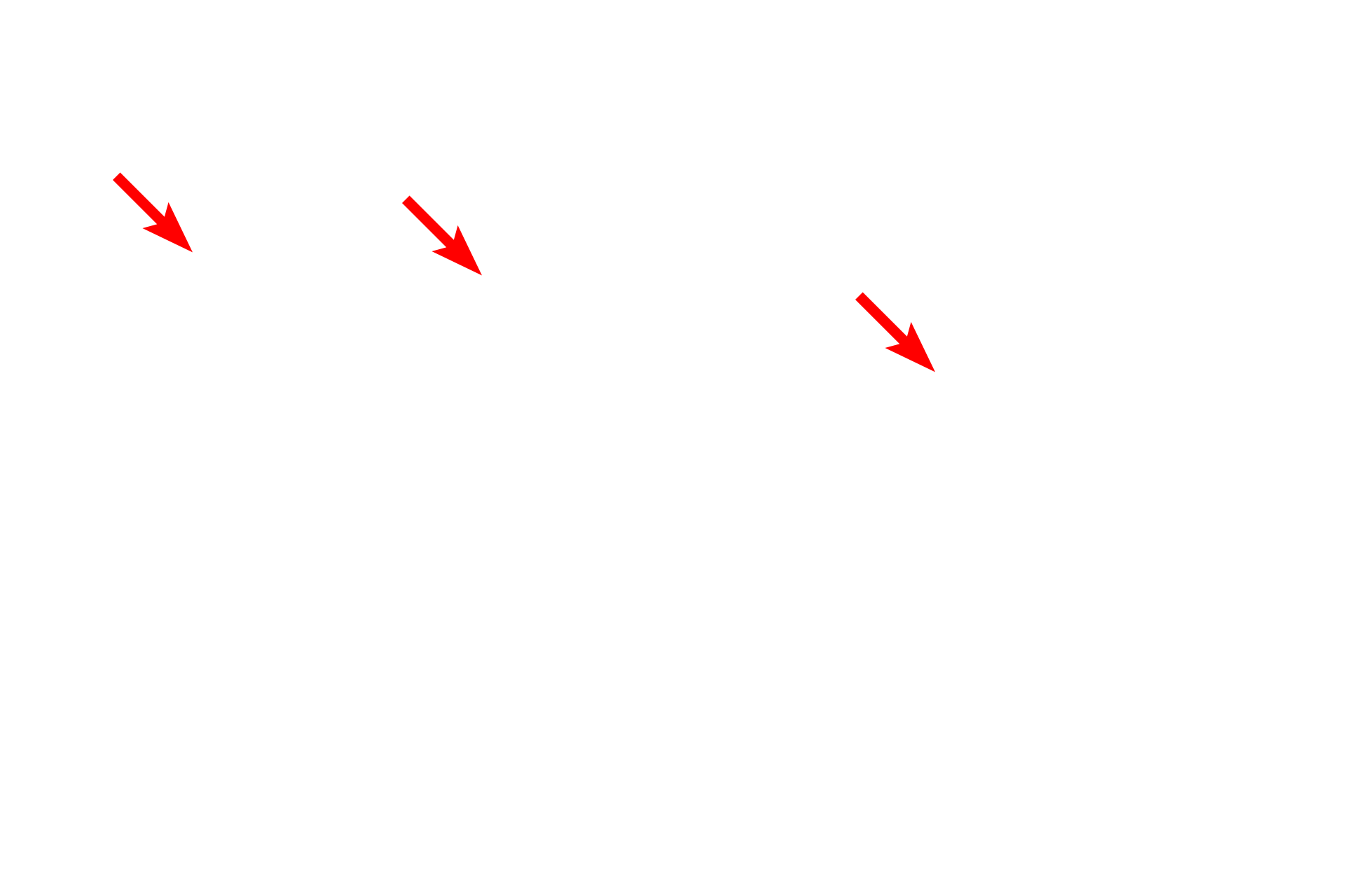 Microvilli <p>A unique feature of the plasma membrane is the glycocalyx, a fuzzy, carbohydrate-rich layer only present on the external cell surface. This layer consists of carbohydrate chains attached to proteins and lipids, as well as secreted proteoglycans.  The glycocalyx provides a microdomain for enzymatic digestion, cell recognition and adhesion.  In this image, the glycocalyx is seen projecting from the tips of small cell processes called microvilli.  10,000x</p>
