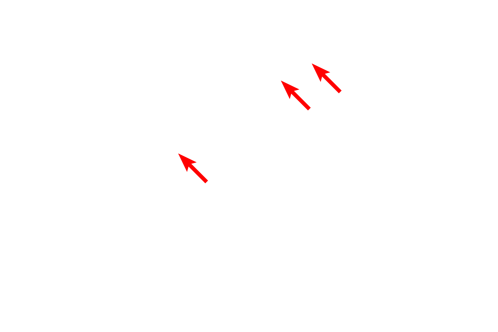  - Inner nuclear membrane <p>This electron micrograph illustrates intracellular membranes, such as SER, RER and the two membranes of the nuclear envelope.  Mitochondria are also composed of two membranes, though they cannot be readily distinguished at this magnification.  Also visible is the connection between the nuclear envelope and the RER.  30,000x</p>
