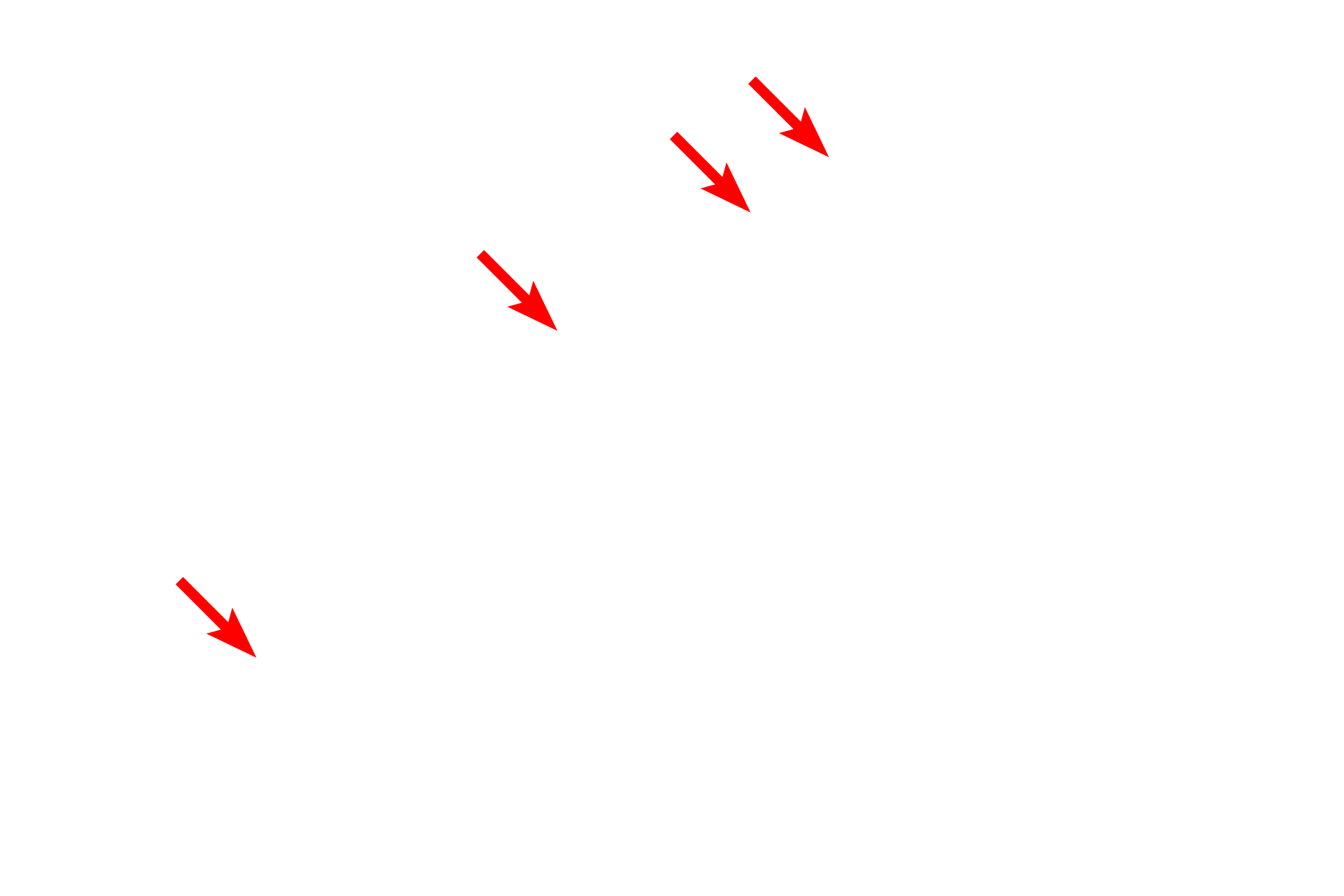  - Outer nuclear membrane <p>This electron micrograph illustrates intracellular membranes, such as SER, RER and the two membranes of the nuclear envelope.  Mitochondria are also composed of two membranes, though they cannot be readily distinguished at this magnification.  Also visible is the connection between the nuclear envelope and the RER.  30,000x</p>

