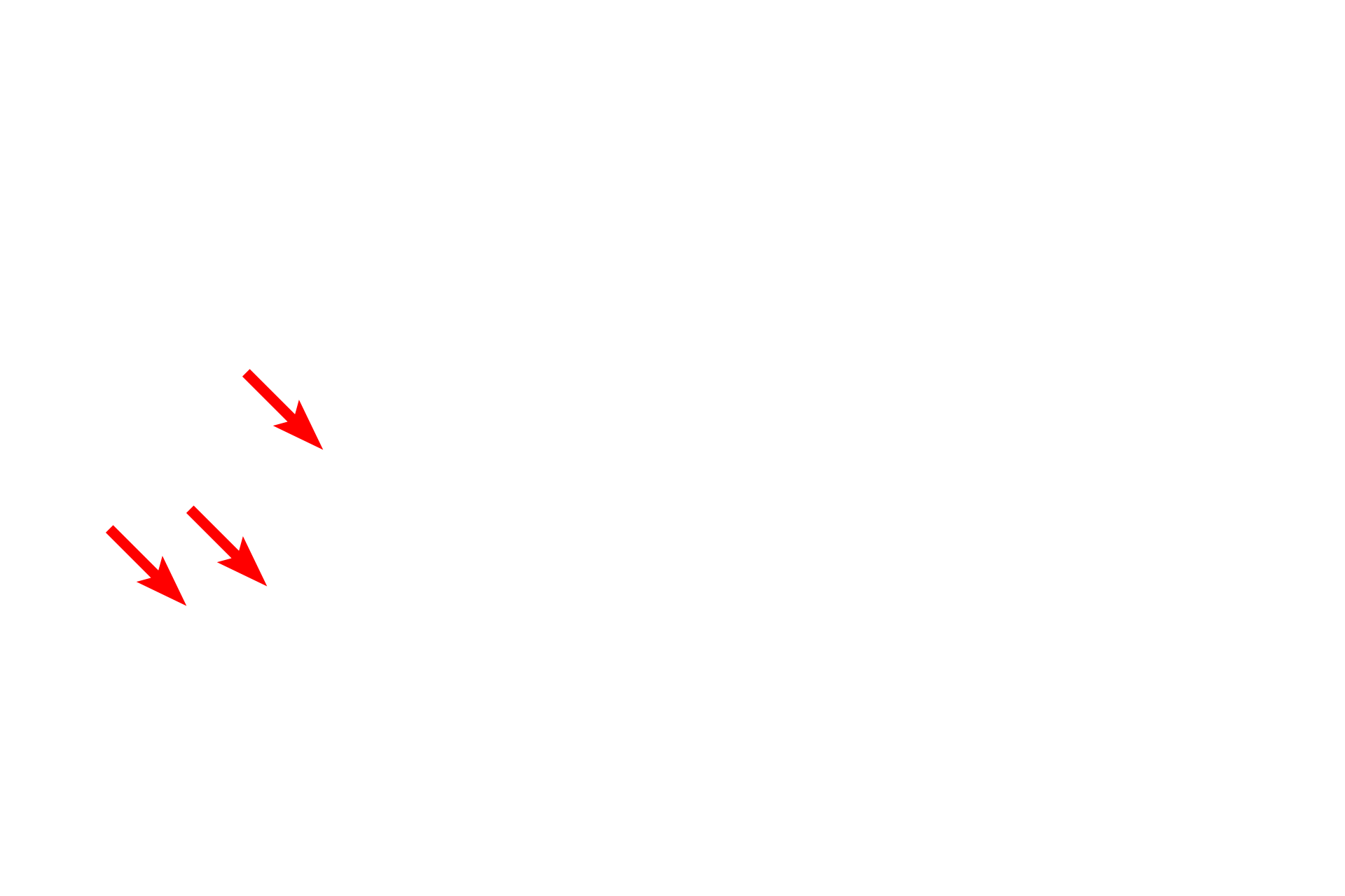 RER <p>This electron micrograph illustrates intracellular membranes, such as SER, RER and the two membranes of the nuclear envelope.  Mitochondria are also composed of two membranes, though they cannot be readily distinguished at this magnification.  Also visible is the connection between the nuclear envelope and the RER.  30,000x</p>
