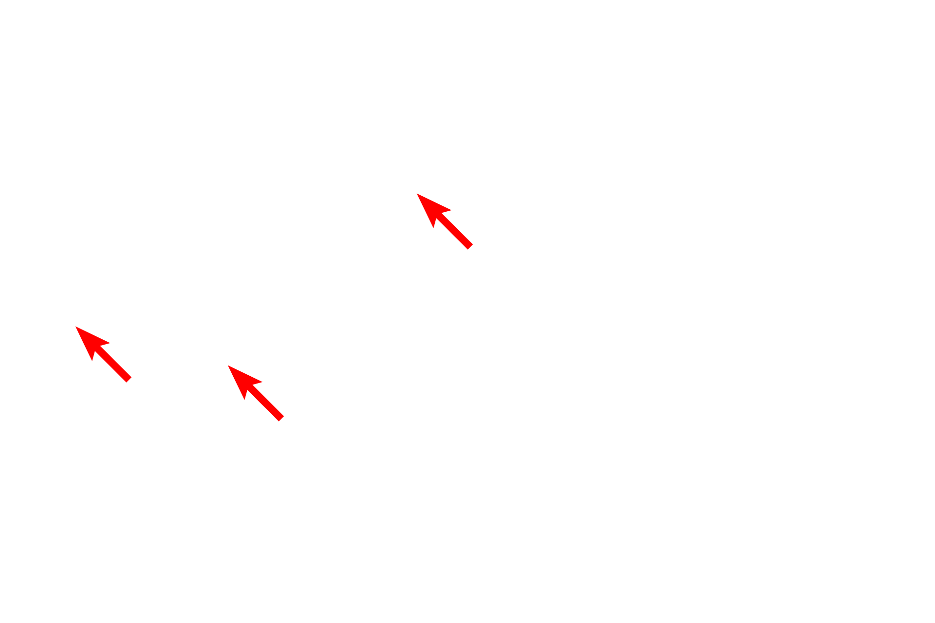 SER <p>This electron micrograph illustrates intracellular membranes, such as SER, RER and the two membranes of the nuclear envelope.  Mitochondria are also composed of two membranes, though they cannot be readily distinguished at this magnification.  Also visible is the connection between the nuclear envelope and the RER.  30,000x</p>
