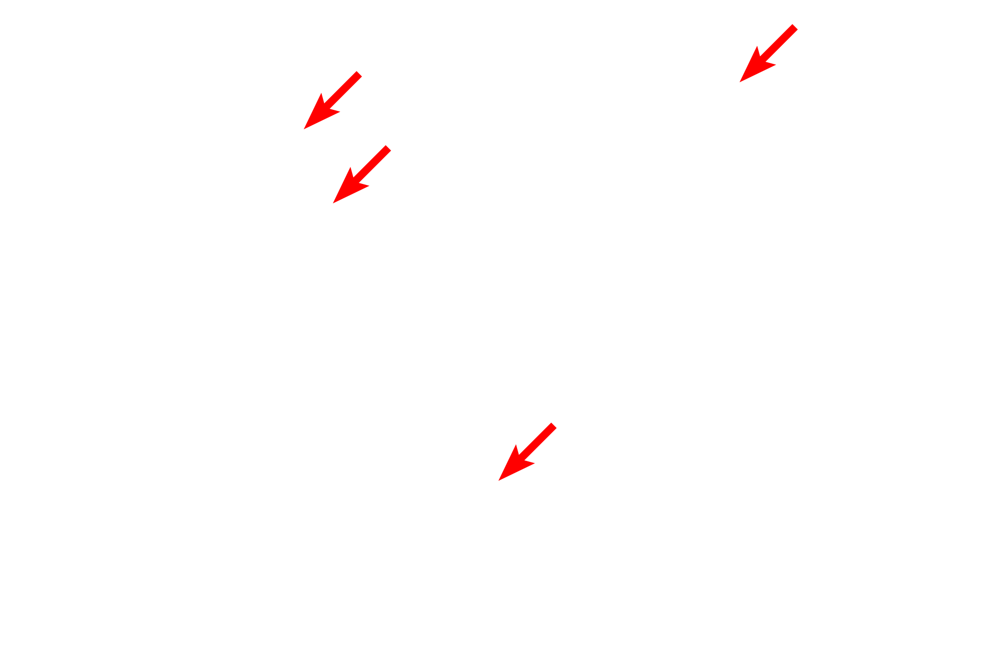 Mitochondria <p>This electron micrograph of a liver cell shows a large number of mitochondria in this active liver cell.  Mitochondria vary in size and shape and are composed of two membranes, with the inner membrane extending into the matrix as shelf-like folds call cristae.  Mitochondria also store calcium in electron dense matrix granules.  Liver 20,000x</p>
