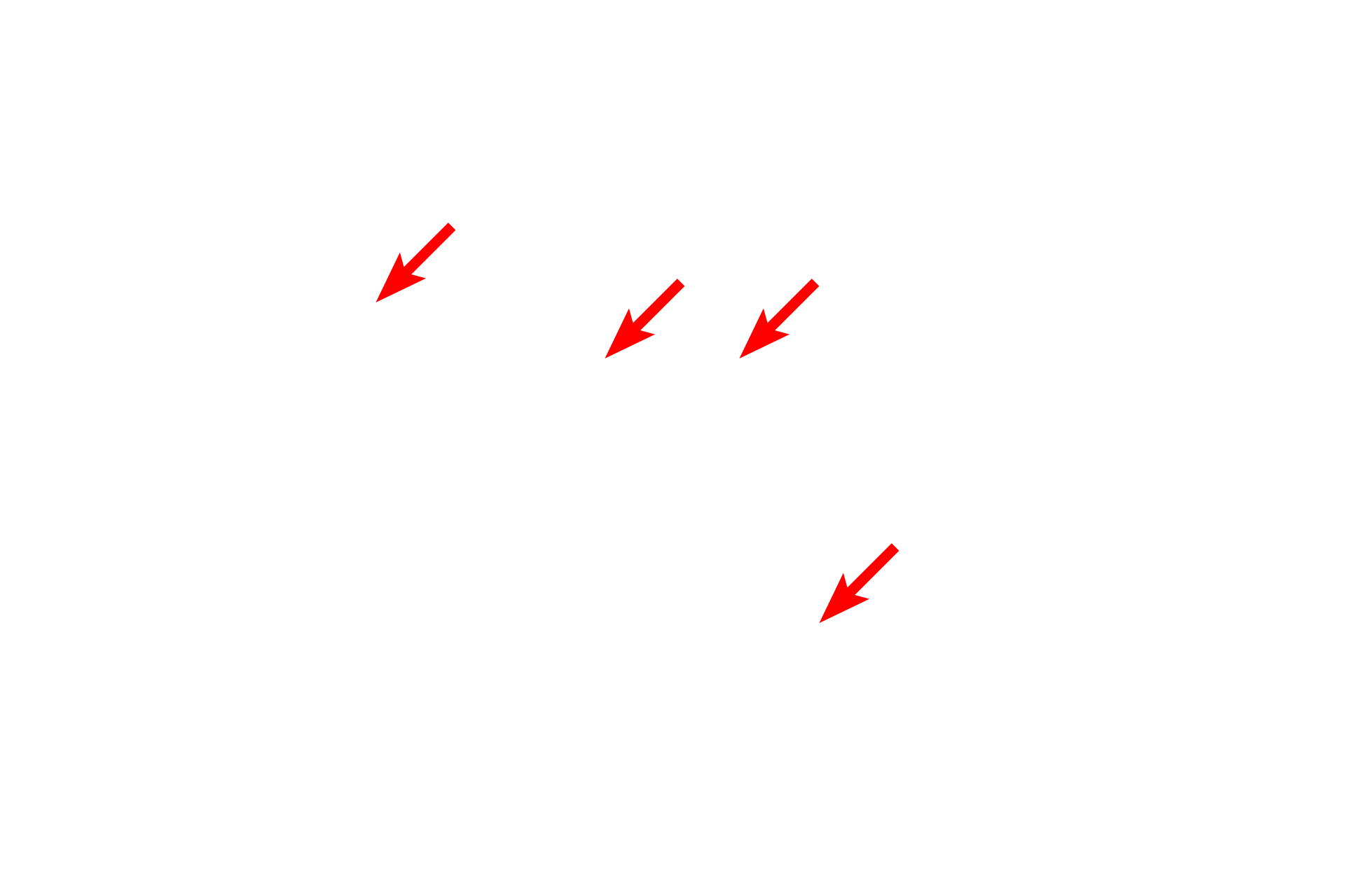  - Matrix <p>This electron micrograph of a liver cell shows a large number of mitochondria in this active liver cell.  Mitochondria vary in size and shape and are composed of two membranes, with the inner membrane extending into the matrix as shelf-like folds call cristae.  Mitochondria also store calcium in electron dense matrix granules.  Liver 20,000x</p>
