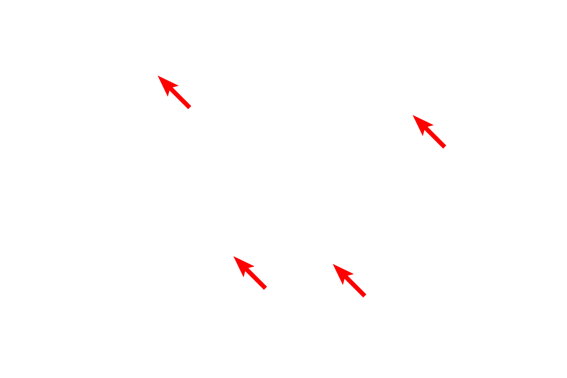  -- Matrix granules <p>This electron micrograph of a liver cell shows a large number of mitochondria in this active liver cell.  Mitochondria vary in size and shape and are composed of two membranes, with the inner membrane extending into the matrix as shelf-like folds call cristae.  Mitochondria also store calcium in electron dense matrix granules.  Liver 20,000x</p>
