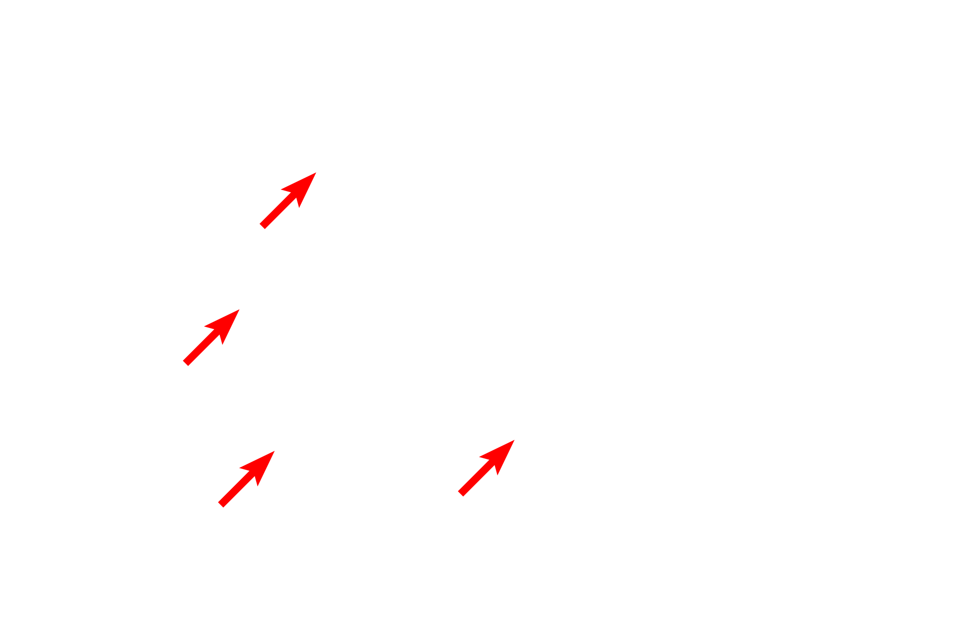 RER <p>This electron micrograph of a liver cell shows a large number of mitochondria in this active liver cell.  Mitochondria vary in size and shape and are composed of two membranes, with the inner membrane extending into the matrix as shelf-like folds call cristae.  Mitochondria also store calcium in electron dense matrix granules.  Liver 20,000x</p>
