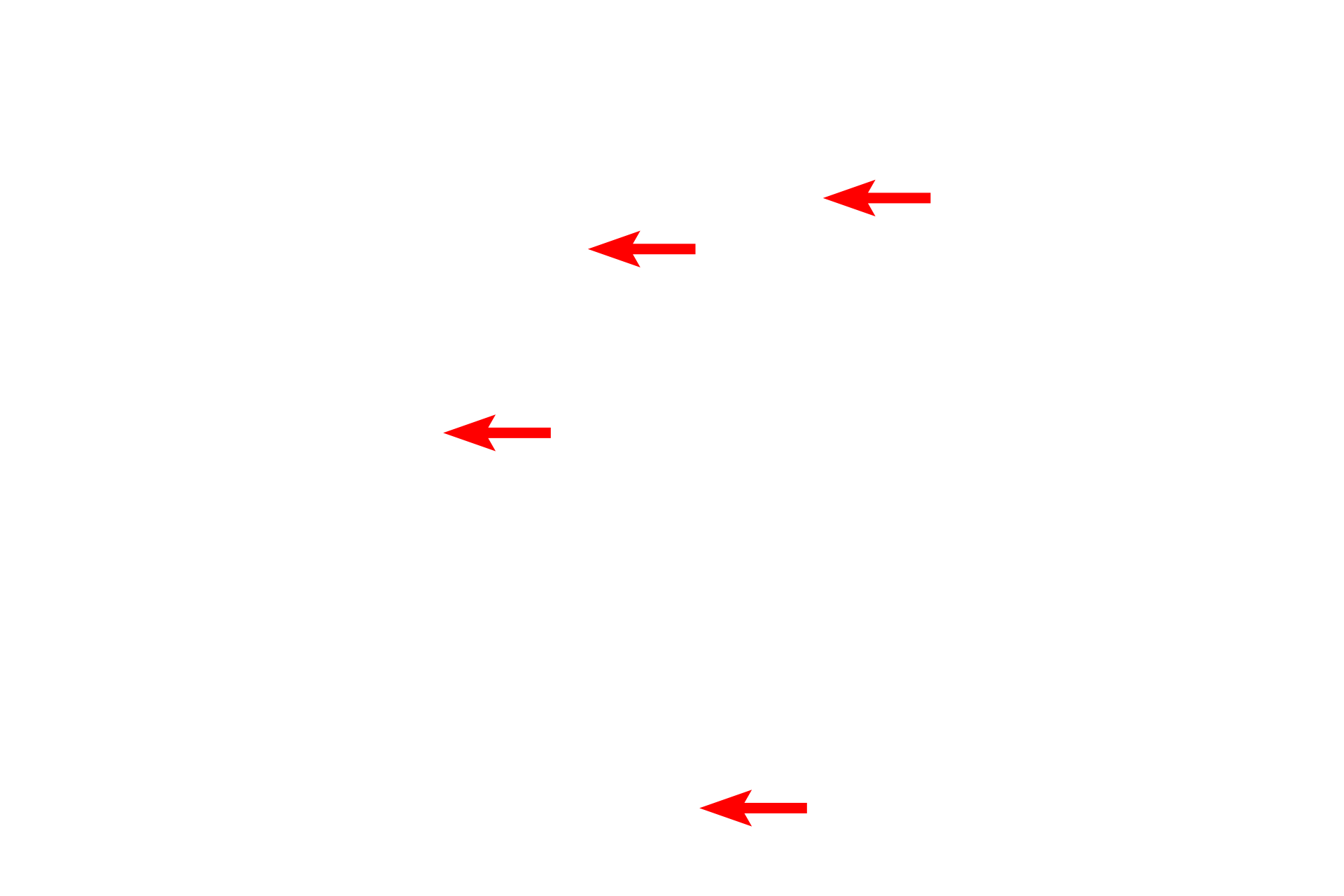 Glycogen granules <p>This electron micrograph of a liver cell shows a large number of mitochondria in this active liver cell.  Mitochondria vary in size and shape and are composed of two membranes, with the inner membrane extending into the matrix as shelf-like folds call cristae.  Mitochondria also store calcium in electron dense matrix granules.  Liver 20,000x</p>
