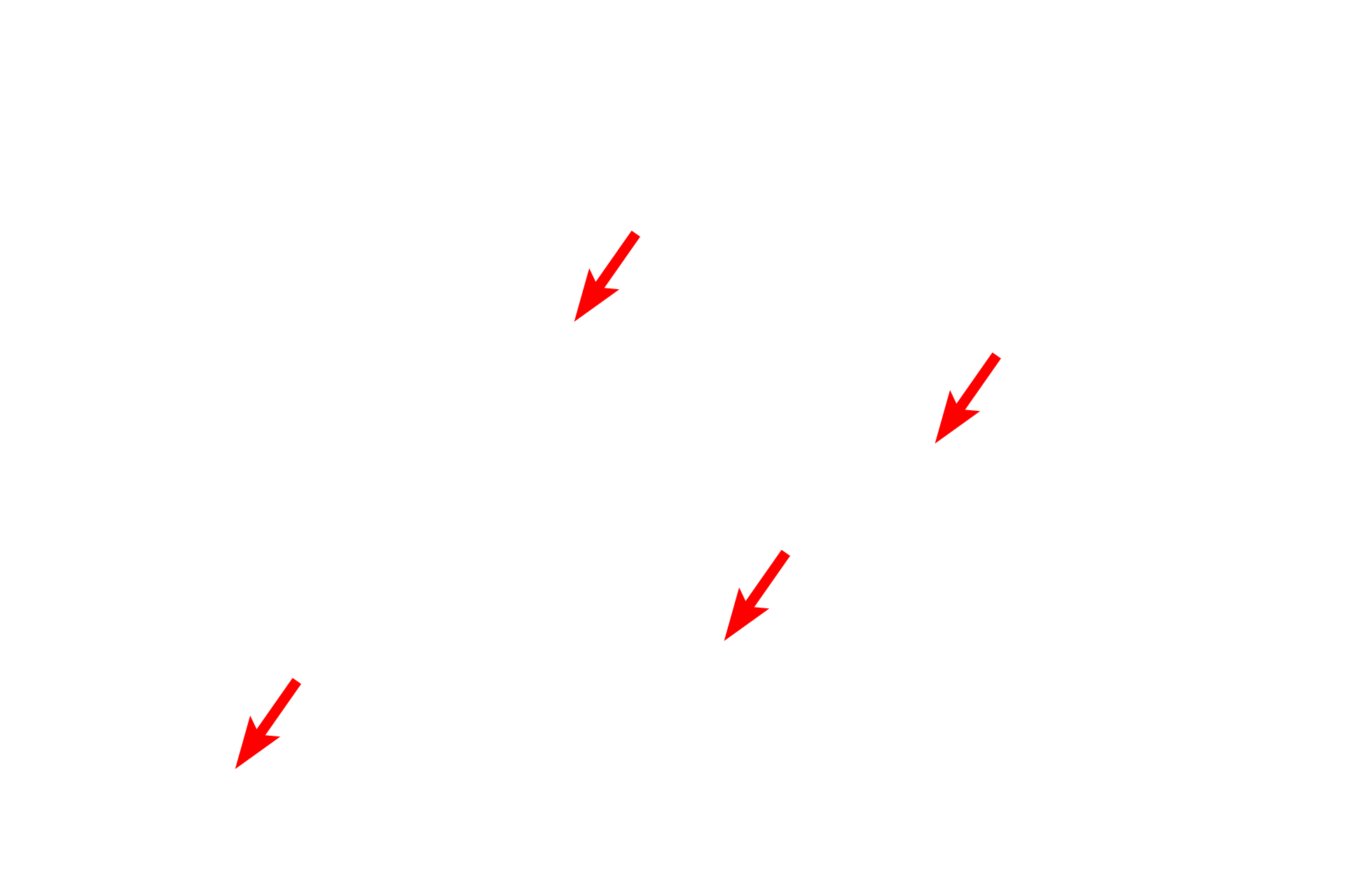  - Cristae <p>This electron micrograph shows numerous mitochondria with extensive, shelf-like cristae.  The mitochondrion is composed of two unit membranes, the inner one of which is folded to form cristae.  Located along the cristal membrane are the enzymes in the respiratory chain, which are essential for oxidative phosphorylation.  The cristae are surrounded by the matrix which contains the enzymes in the Krebs cycle.  Liver 40,000x</p>
