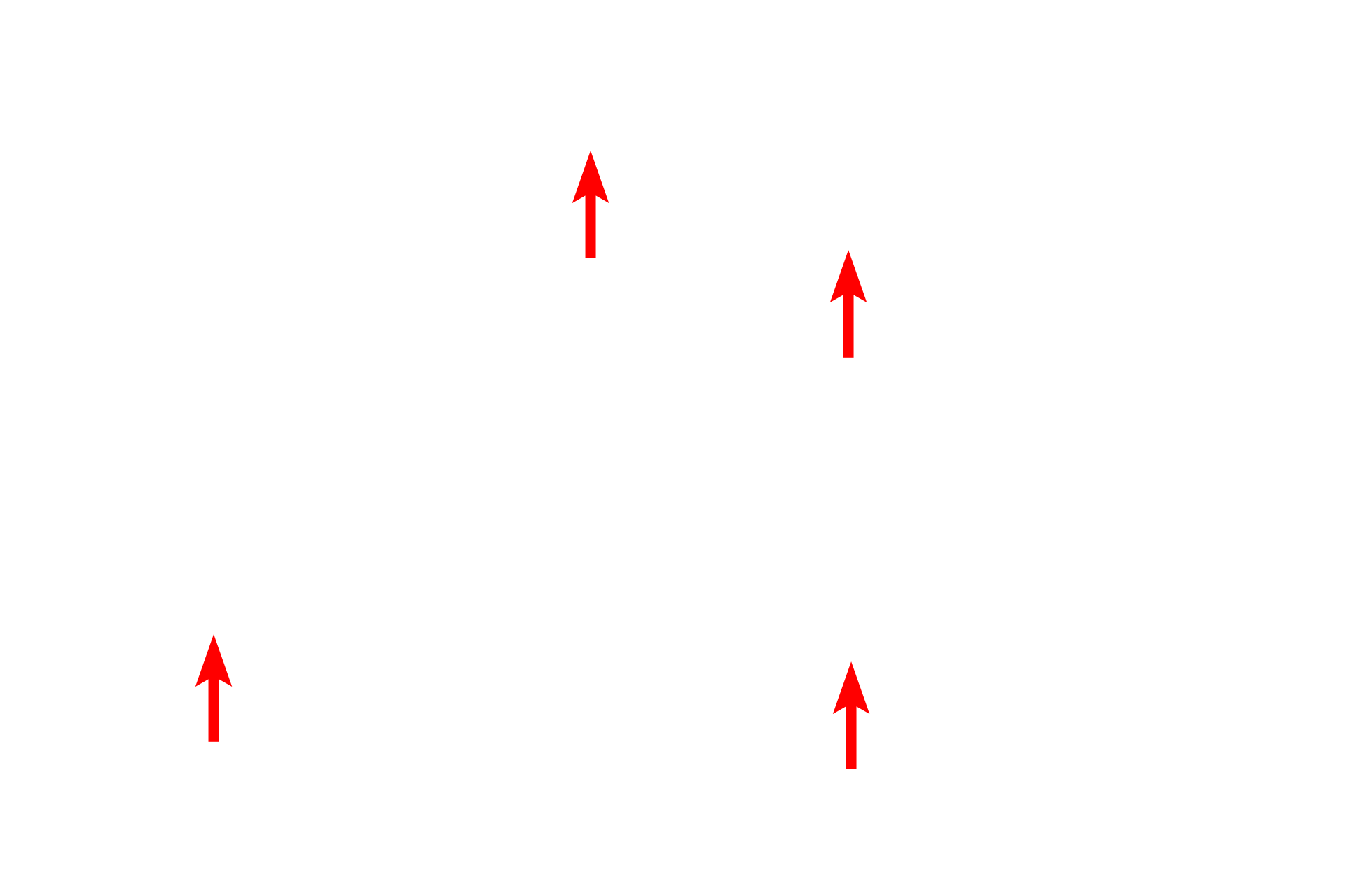 Polysomes <p>This electron micrograph shows numerous mitochondria with extensive, shelf-like cristae.  The mitochondrion is composed of two unit membranes, the inner one of which is folded to form cristae.  Located along the cristal membrane are the enzymes in the respiratory chain, which are essential for oxidative phosphorylation.  The cristae are surrounded by the matrix which contains the enzymes in the Krebs cycle.  Liver 40,000x</p>
