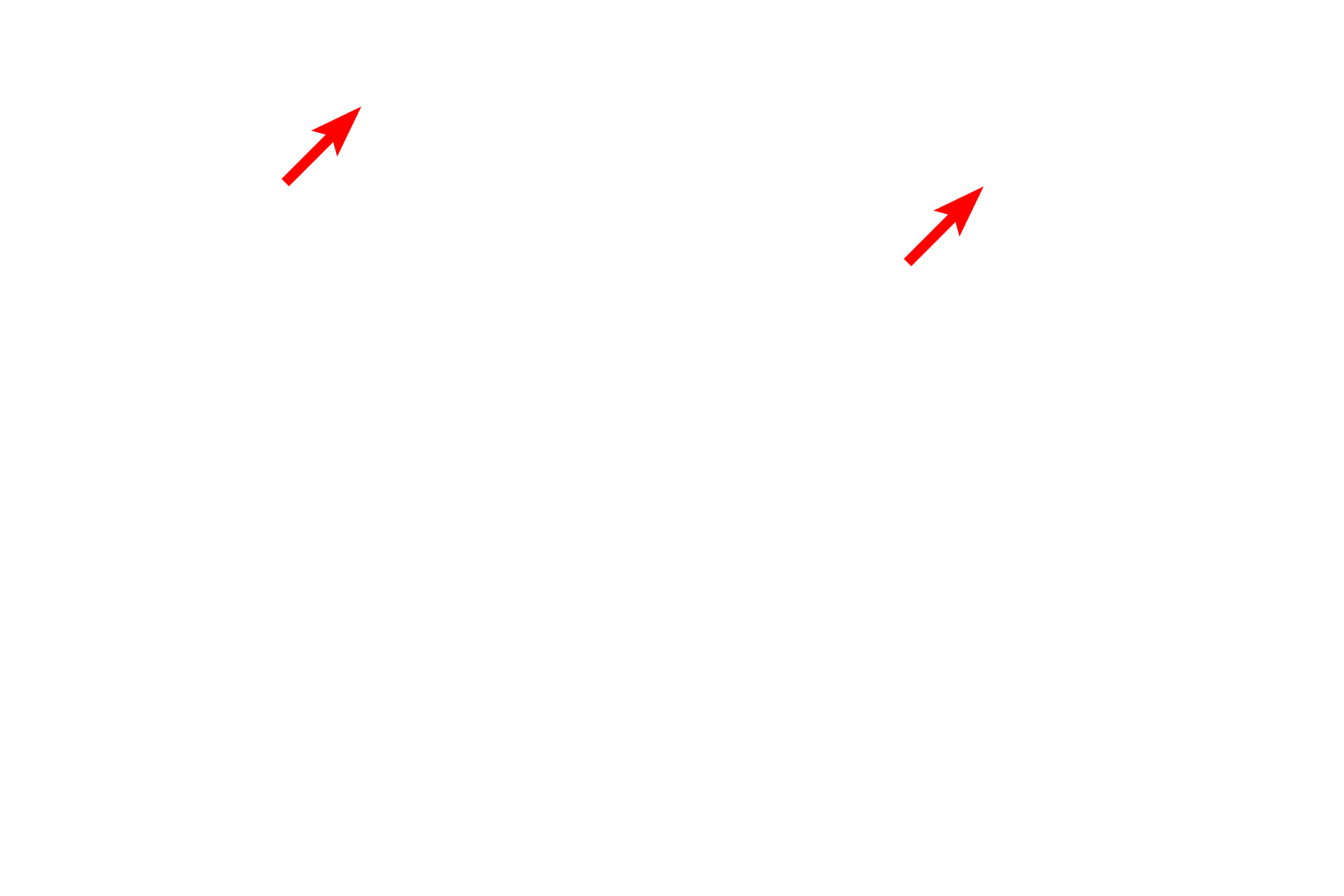 Lysosomes <p>This electron micrograph shows numerous mitochondria with extensive, shelf-like cristae.  The mitochondrion is composed of two unit membranes, the inner one of which is folded to form cristae.  Located along the cristal membrane are the enzymes in the respiratory chain, which are essential for oxidative phosphorylation.  The cristae are surrounded by the matrix which contains the enzymes in the Krebs cycle.  Liver 40,000x</p>
