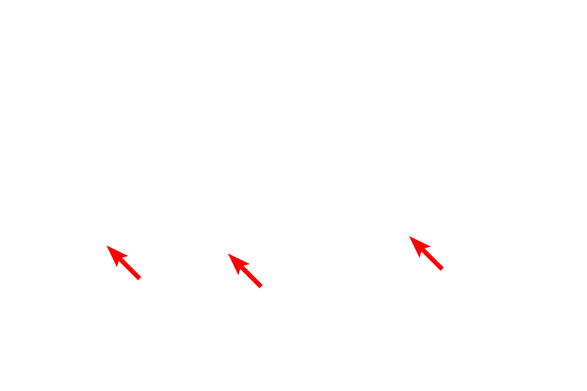  - Matrix <p>The mitochondrion is composed of two unit membranes, the inner one of which is folded to form cristae, which project into the central matrix of the mitochondrion.  The cristae provide for increased surface area for the placement of the enzymes of the respiratory chain carrying out oxidative phosphorylation.  60,000x</p>
