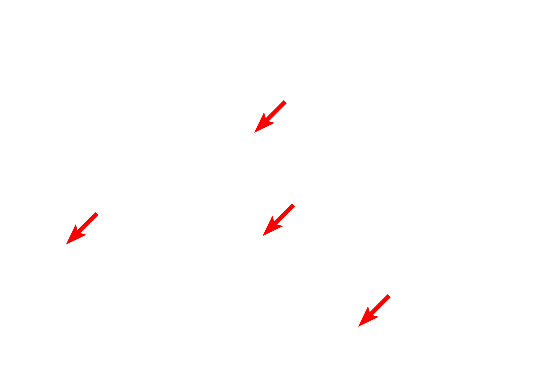  - Cristae <p>Shape and size of mitochondria are highly variable.  Mitochondria can be ellipsoid to filamentous and up to 10 microns in length.  Mitochondria can also branch.  40,000x</p>
