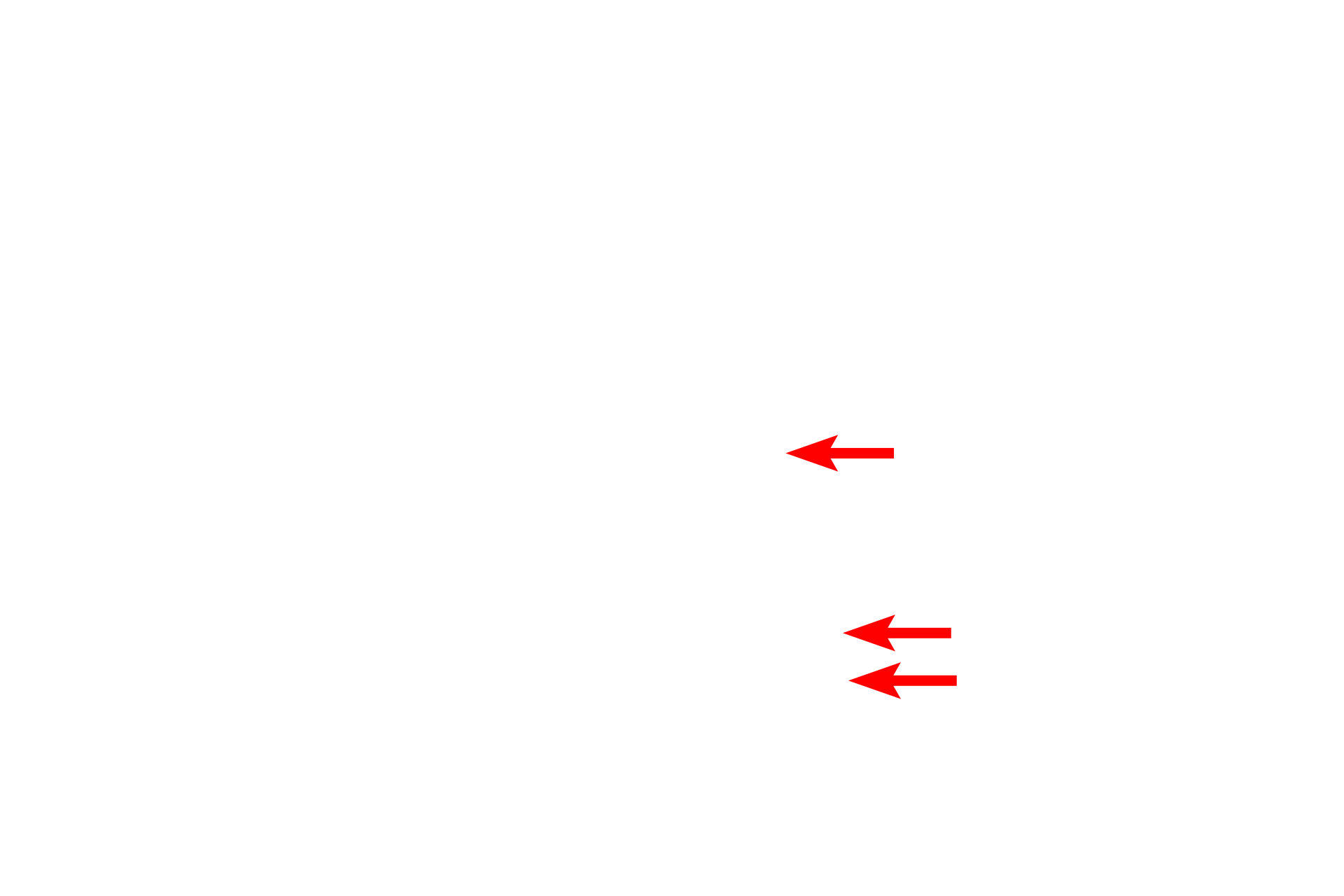  - Matrix granules <p>Shape and size of mitochondria are highly variable.  Mitochondria can be ellipsoid to filamentous and up to 10 microns in length.  Mitochondria can also branch.  40,000x</p>
