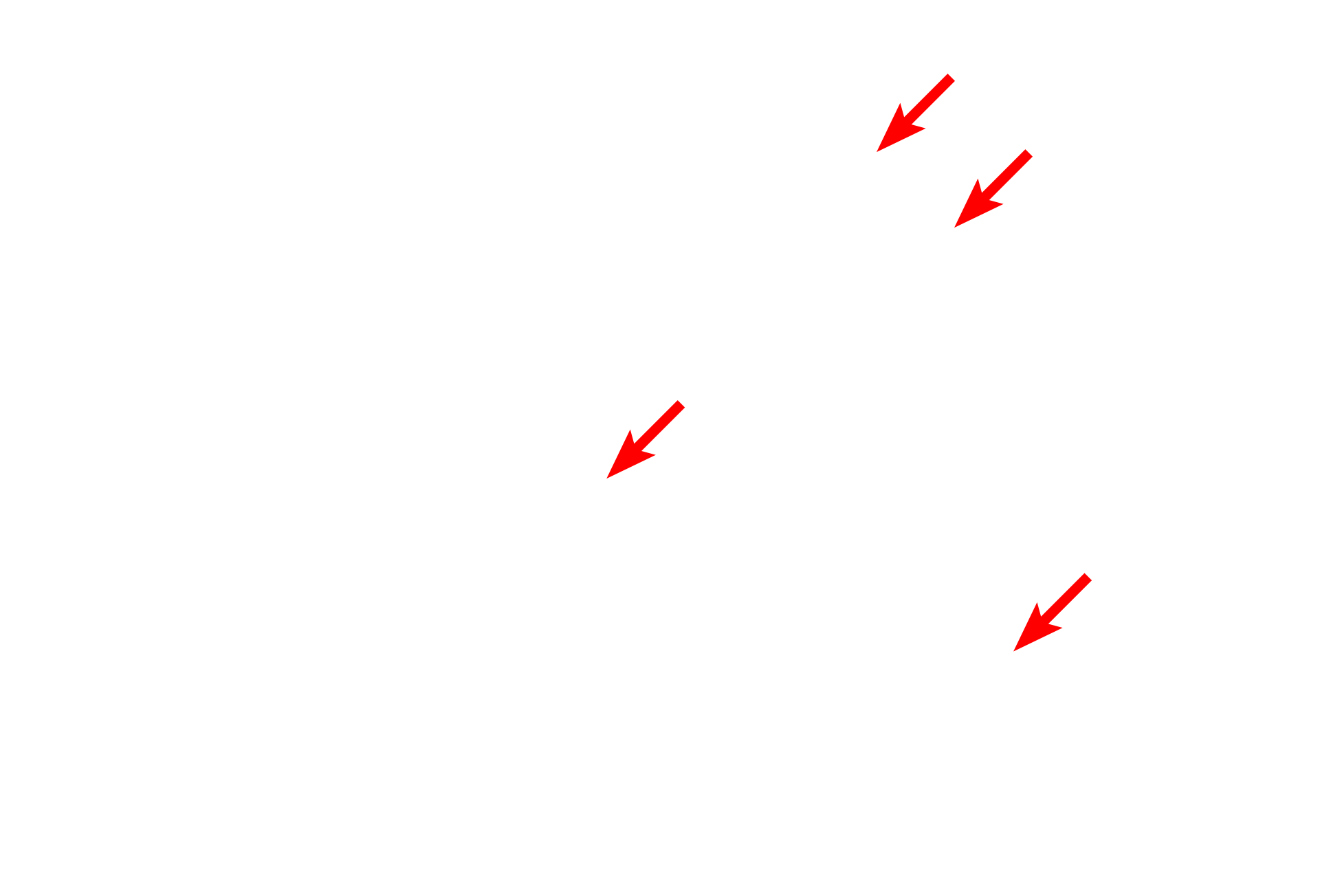 SER <p>The mitochondria present in this electron micrograph possess tubular cristae rather than the flattened shelf-like cristae which are present in most cells.  Mitochondria with tubular cristae are a common feature of most steroid-producing cells.  40,000x</p>

