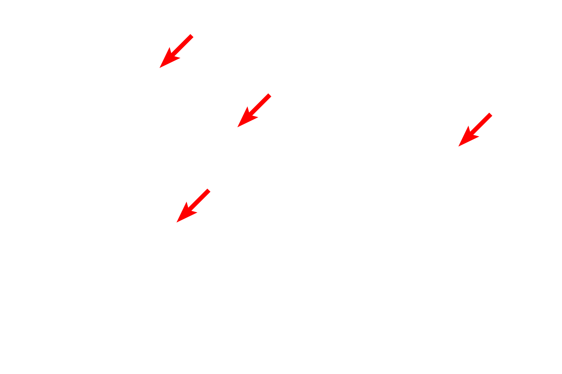 SER <p>Mitochondria in most steroid-secreting cells have tubular cristae rather than shelf-like cristae seen in mitochondria in other cells.  As with the shelf-like cristae, tubular cristae are formed by invaginations of the inner mitochondrial membrane.  Also prominent in this micrograph is abundant SER, another feature common in steroid-producing cells.  Adrenal cortex  40,000x</p>
